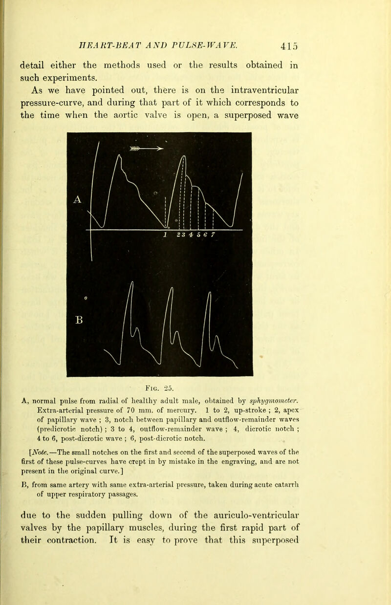 detail either the methods used or the results obtained in such experiments. As we have pointed out, there is on the intraventricular pressure-curve, and during that part of it which corresponds to the time when the aortic valve is open, a superposed wave Fig. 25. A, normal pulse from radial of healthy adult male, obtained by sphygmometer. Extra-arterial pressure of 70 mm. of mercury. 1 to 2, up-stroke ; 2, apex of papillary wave ; 3, notch between papillary and outflow-remainder waves (predicrotie notch) ; 3 to 4, outflow-remainder wave ; 4, dicrotic notch ; 4 to 6, post-dicrotic wave ; 6, post-dicrotic notch. [Note.—The small notches on the first and second of the superposed waves of the first of these pulse-curves have crept in by mistake in the engraving, and are not present in the original curve.] 15, from same artery with same extra-arterial pressure, taken during acute catarrh of upper respiratory passages. due to the sudden pulling down of the auriculo-ventricular valves by the papillary muscles, during the first rapid part of their contraction. It is easy to prove that this superposed
