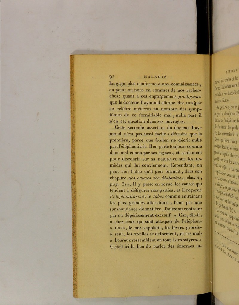 > \ I V î~ 92 MALADIE langage plus conforme à nos connaissances, au point où nous en sommes de nos recher- ches; quant à ces engorgemens prodigieux que le docteur Raymond affirme être mis [par ce célèbre médecin au nombre des symp- tômes de ce formidable mal, nulle part il n’en est question dans ses ouvrages. Cette seconde assertion du docteur Ray- mond n’est pas aussi facile à détruire que la première, parce que Galien ne décrit nulle partl’éléphantiasis. lien parle toujours comme d’un mal connu par ses signes, et seulement pour discourir sur sa nature et sur les re- mèdes qui lui conviennent. Cependant, on peut voir l’idée qu’il s’en formait, dans son chapitre des causes des Maladies , clas. 5 , pag. 317. 11 y passe en revue les causes qui tendent à défigurer nos parties, et il regarde Féléphantiasis et le tabes comme entraînant les plus grandes altérations , l’une par une surabondance de matière , l’autre au contraire par un dépérissement excessif, u Car, dit-il, » chez ceux qui sont attaqués de l’éléphan- » liasis , le nez s’applatit, les lèvres grossis- » sent, les oreilles se déforment, et ces mal* » heureux ressemblent en tout à des satyres. » C’était ici le lieu de parler des énormes tu- jyÜPllAT1 fcuUBW»®1 j^wrlqüeb1 moins le silence. Oa peut voir, par les j el pat la description U decins de l’antiquité ne fa de la tumeur des pieds 1 de dois neanmoins a la ®*>fi pinil noir ■ ^Meilécri»,; * k ‘1,61«* Hüe/i 1 le 'fini le est i tains ■O, Nt j \, % n
