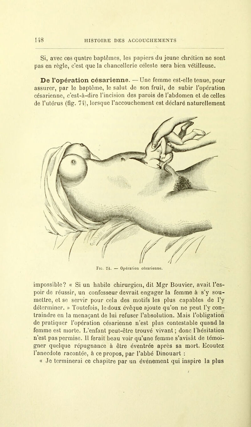 Si, avec ces quatre baptêmes, les papiers du jeune chrétien ne sont pas en règle, c’est que la chancellerie céleste sera bien vétilleuse. De l’opération césarienne. — Une femme est-elle tenue, pour assurer, par le baptême, le salut de son fruit, de subir l’opération césarienne, c’est-à-dire l’incision des parois de l’abdomen et de celles de l’utérus (fig. 74), lorsque l’accouchement est déclaré naturellement Fig. 74. — Opération césarienne. impossible? « Si un habile chirurgien, dit Mgr Bouvier, avait l’es- poir de réussir, un confesseur devrait engager la femme à s’y sou- mettre, et se servir pour cela des motifs les plus capables de l’y déterminer. » Toutefois, le doux évêque ajoute qu’on ne peut l’y con- traindre en la menaçant de lui refuser l’absolution. Mais l’obligation de pratiquer l’opération césarienne n’est plus contestable quand la femme est morte. L’enfant peut-être trouvé vivant ; donc l’hésitation n’est pas permise. Il ferait beau voir qu’une femme s’avisât de témoi- gner quelque répugnance à être éventrée après sa mort. Ecoutez l’anecdote racontée, à ce propos, par l’abbé Dinouart : « Je terminerai ce chapitre par un événement qui inspire la plus