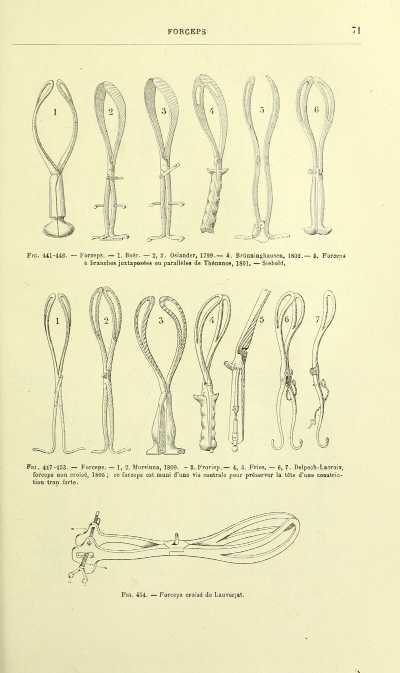 Fig. 441-446. — Forceps. — 1. Boër. — 2, 3. Osiander, 1799.— 4. Brtinninghausen, 1802.— 5. Forceos à branches juxtaposées ou parallèles de Thénance, 1801. — Siebold. Fig. 447-453. — Forceps. — 1, 2. Mursinna, 1800. - 3.Froriep.— 4, 5. Fries. — 6, 7. Delpech-Lacroir, forceps non croisé, 1805 ; ce forceps est muni d’une vis centrale pour préserver la tète d’une constric- tion troo forte. Fig. 454. — Forceps croisé de Lauverjat.