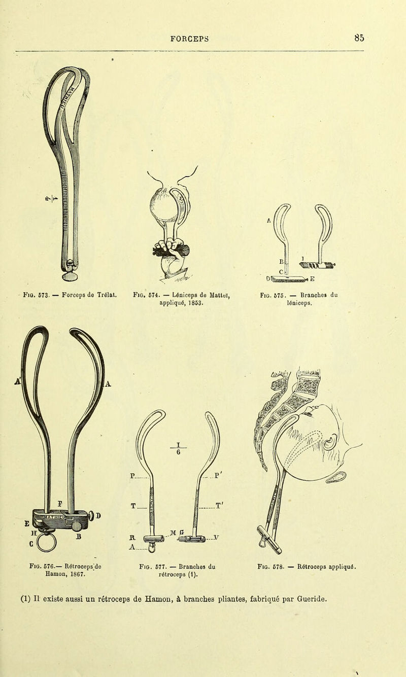 Fia. 573. — Forceps de Trélat. Fig. 574. — Léniceps de Mattel, appliqué, 1853. Fig. 575. — Branche» du léniceps. (1) Il existe aussi un rétroceps de Hamon, à branches pliantes, fabriqué par Gueride.