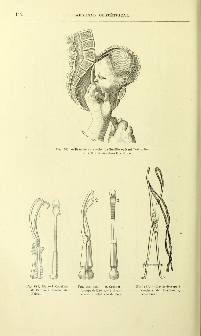 Fig. 682. — Branche du crochet de Smellie opérant l'extraction de la tête laissée dans la matrice. Fig. 683, 684. — 1. Crochets de Peu. — 2. Crochet de Fried. Fig. 635, 686. — 2. Crochet- furceps de Dawis.— 3. Bran- che du crochet vue de face. Fig- 687. — Levier-forceps à crochets de Uerbiniaux, avec lacs.