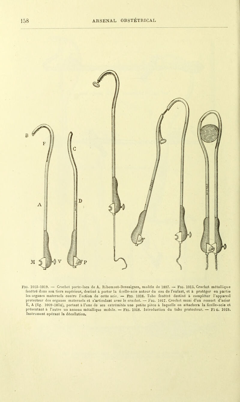 Fig. 1015-1019. — Crochet porte-lacs de A. Ribemont-Dessaignes, modèle de 1887. — Fig. 1015. Crochet métallique fenôtré dans son tiers supérieur, destiné à porter la licelle-scie autour du cou de l’enfant, et à protéger en partie les organes maternels contre l’action de cette scie. — Fig. 1016. Tube fenôtré destiné à compléter l’appareil protecteur des organes maternels et s’articulant avec le crochet. — Fig. 1017. Crochet muni d’un ressort d’acier E, A (fig. 1009-1014), portant à l’une de ses extrémités une petite pièce à laquelle on attachera la ficelle-scie et présentant à l’autre un anneau métallique mobile. — Fig. 1018. Introduction du tube protecteur. — Fl G. 1019. Instrument opérant la décollation.