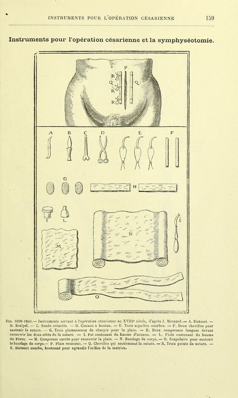 Instruments pour l’opération césarienne et la symphyséotomie. Fio. 1020-1040.— Instruments servant à l’opération césarienne au XVIII8 siècle, d’après J. Mesnard.— A. Bistouri.— B. Scalpel. — C. Sonde crénelée. — D. Ciseaux à bouton. — E. Trois aiguilles courbes. — F. Deux chevilles pour soutenir la suture. — G. Trois plumasseaux de charpie pour la plaie. — H. Deux compresses longues devant recouvrir les deux côtés de la suture. — I. Pot contenant du baume d’arcœus. — L. Fiole contenant du baume du Pérou. — M. Compresse carrée pour recouvrir la plaie. — N. Bandage de corps.— 0. Scapulaire pour soutenir le bandage de corps.— P. Plaie recousu . — Q. Chevilles qui soutiennent la suture. — R. Trois points de suture. — S. Bistouri courbe, boutonné pour agrandir l’orifice de la matrice.