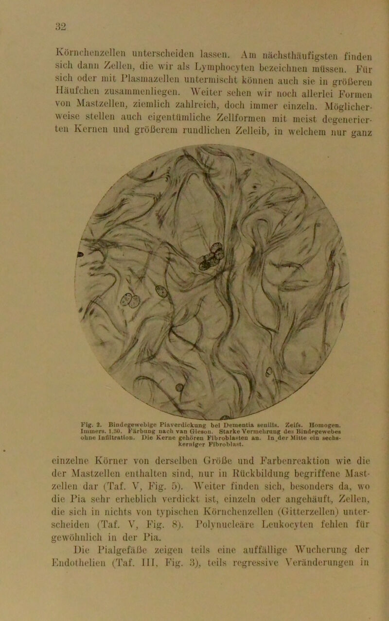 Ivornchenzellen unterscheiden lassen. Am nachsthaufigsten finden sich dann Zellen, die wir ills Lymphocyteu bezeiclinen miissen. FUr sich odor mit Plasmazellen untermischt konnen aucli sie in grofleren Haufchen zusainmenliegen. Weiter sehen wir nodi allerlci Formen von Mastzellen, ziemlich zahlreich, docli immer einzeln. Moglicher- weise stellen aucli eigentilmliche Zellformen mit moist degenerier- ten Kernen und grofierem rundlichen Zelleib, in welchem nur ganz ohne Infiltration. Die Kerne gekoren Fibroblastcn an. In der Milte t in secbs- kernigor Fibroblast. einzelne Kdrner von derselben Grblie und Farbenreaktion wie die der Mastzellen euthalten sind, nur in IiUckbildung bcgriffene Mast- zellen dar (Taf. V, Fig. 5). Weiter finden sich, besonders da, wo die ,1’ia sehr erheblich verdickt ist, einzeln oder angehauft, Zellen, die sich in niclits von typischcn Kornchenzellen (Gitterzellen) unter- scheiden (Taf. V, Fig. 8). Polynuclearc Leukocyten fehlen fiir gewohnlich in der Pia. Die Pialgefiifie zeigen toils cine auffallige Wucherung der Endothelien (Taf. Ill, Fig. 3), toils regressive Yeranderungen in