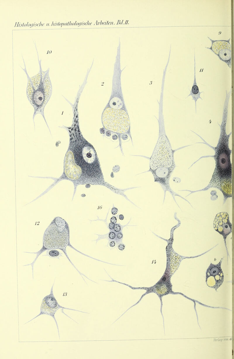 Histologische ii. histojudhologische Arbeiten. Belli.