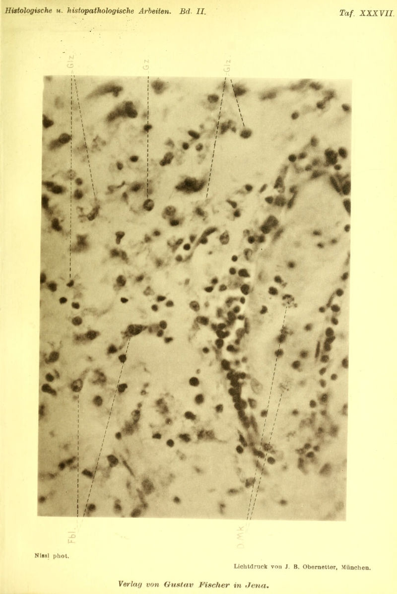 Histologische u. histopathologische Arbeiten. Bd. II. Taf XXKYII M JD Nissl phot. Lichtdruck von J. B. Obernetter, München. Verlag von Gustav Fischer in Jetia,