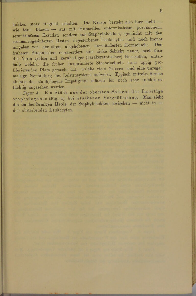 kokken stark tingibel erhalten. Die Kruste besteht also hier nicht — wie beim Ekzem — ans mit Hornzellen untermischtem, geronnenem, serofibrinösem Exsudat, sondern aus Staphylokokken, gemischt mit den zusammengesinterten Resten abgestorbener Leukocyten und noch immer umgeben von der alten, abgehobenen, unveränderten Hornschicht. Den früheren Blasenhoden repräsentiert eine dicke Schicht neuer, noch über die Norm grofser und kernhaltiger (parakeratotischer) Hornzellen, unter- halb welcher die früher komprimierte Stachelschicht einer üppig pio liferierenden Platz gemacht hat, welche viele Mitosen und eine unregel- mäfsige Neubildung des Leistensystems aufweist. Typisch mittelst Kruste abheilende, staphylogene Impetigines müssen für noch sehr infektions- tüchtig angesehen werden. Figur 4. Ein Stück aus der obersten Schicht der Impetigo staphylogenes (Fig. 1) bei stärkerer Vergröfserung. Man sieht die traubenförmigen Herde der Staphylokokken zwischen nicht in den absterbeuden Leukocyten.