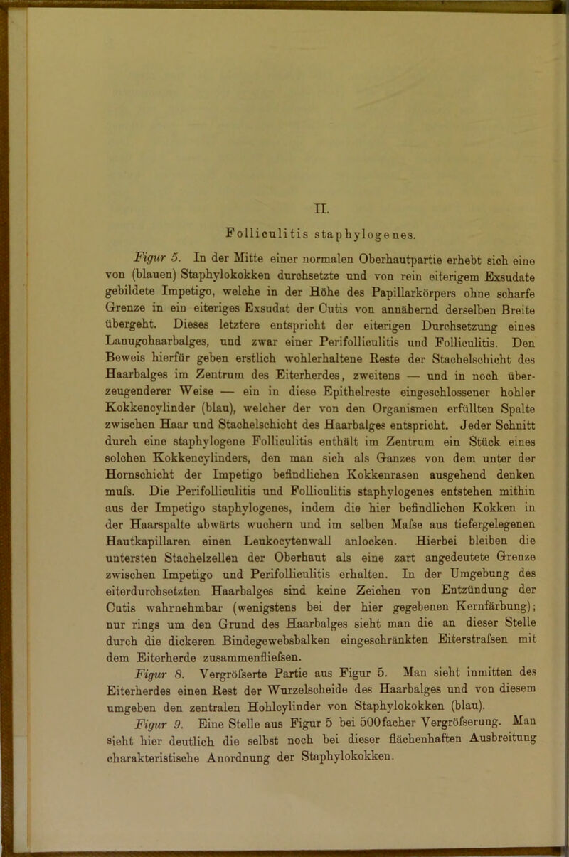 II. Folliculitis staphylogenes. Figur 5. In der Mitte einer normalen Oberhautpartie erhebt sich eine von (blauen) Staphylokokken durchsetzte und von rein eiterigem Exsudate gebildete Impetigo, welche in der Höhe des Papillarkörpers ohne scharfe Grenze in ein eiteriges Exsudat der Cutis von annähernd derselben Breite übergeht. Dieses letztere entspricht der eiterigen Durchsetzung eines Lanugohaarbalges, und zwar einer Perifolliculitis und Folliculitis. Den Beweis hierfür geben erstlich wohlerhaltene Reste der Stachelschicht des Haarbalges im Zentrum des Eiterherdes, zweitens — und in noch über- zeugenderer Weise — ein in diese Epithelreste eingeschlossener hohler Kokkencylinder (blau), welcher der von den Organismen erfüllten Spalte zwischen Haar und Stachelschicht des Haarbalges entspricht. Jeder Schnitt durch eine staphylogene Folliculitis enthält im Zentrum ein Stück eines solchen Kokkencylinders, den man sioh als Ganzes von dem unter der Hornschicht der Impetigo befindlichen Kokkenrasen ausgehend denken mufs. Die Perifolliculitis und Folliculitis staphylogenes entstehen mithin aus der Impetigo staphylogenes, indem die hier befindlichen Kokken in der Haarspalte abwärts wuchern und im selben Mafse aus tiefergelegenen Hautkapillaren einen Leukocytenwall anlocken. Hierbei bleiben die untersten Stachelzellen der Oberhaut als eine zart angedeutete Grenze zwischen Impetigo und Perifolliculitis erhalten. In der Umgebung des eiterdurchsetzten Haarbalges sind keine Zeichen von Entzündung der Cutis wahrnehmbar (wenigstens bei der hier gegebenen Kernfärbung); nur rings um den Grund des Haarbalges sieht man die an dieser Stelle durch die dickeren Bindegewebsbalken eingeschränkten Eiterstrafsen mit dem Eiterherde zusammenfliefsen. Figur 8. Vergrößerte Partie aus Figur 5. Man sieht inmitten des Eiterherdes einen Rest der Wurzelscheide des Haarbalges und von diesem umgeben den zentralen Hohlcylinder von Staphylokokken (blau). Figur 9. Eine Stelle aus Figur 5 bei 500facher Vergröfserung. Man sieht hier deutlich die selbst noch bei dieser flächenhaften Ausbreitung charakteristische Anordnung der Staphylokokken.