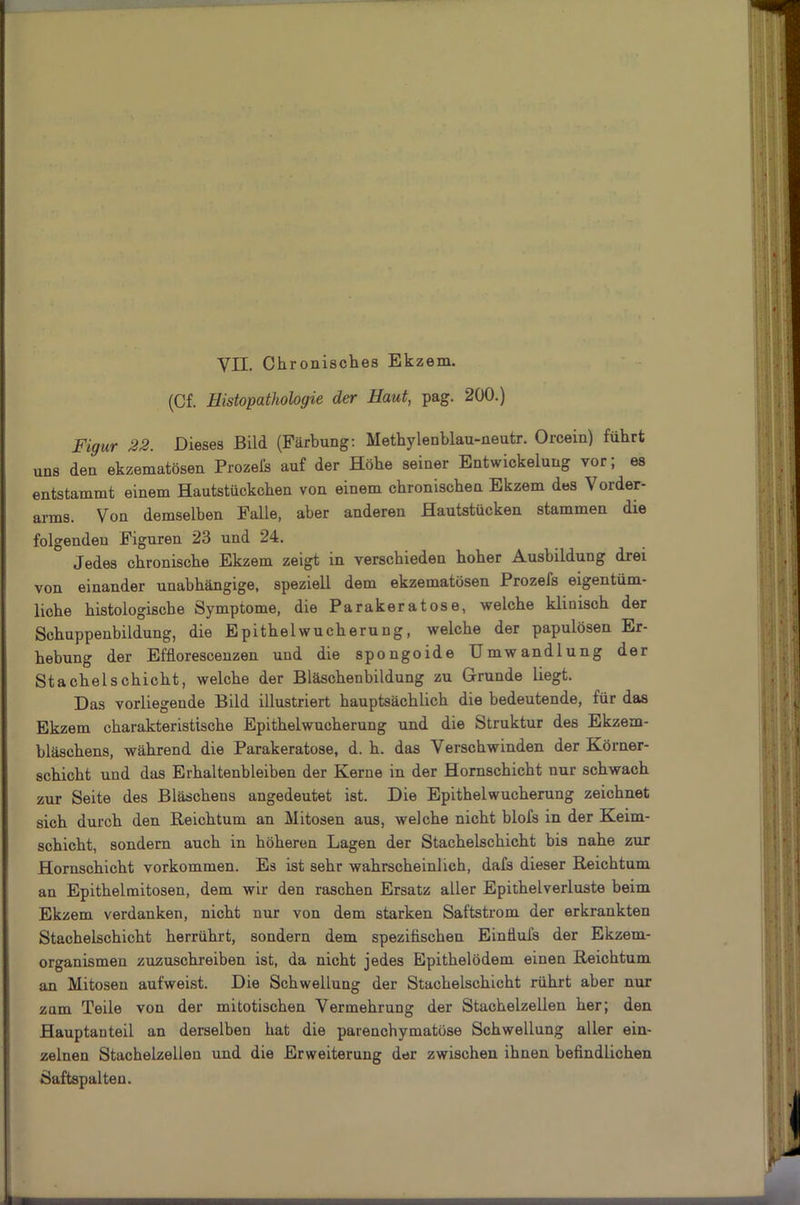 YII. Chronisches Ekzem. (Cf. Histopathologie der Haut, pag. 200.) Figur 22. Dieses Bild (Färbung: Methylenblau-neutr. Orcein) führt uns den ekzematösen Prozeis auf der Höhe seiner Entwickelung vor; es entstammt einem Hautstückchen von einem chronischen Ekzem des Vorder- arms. Von demselben Falle, aber anderen Hautstücken stammen die folgenden Figuren 23 und 24. Jedes chronische Ekzem zeigt in verschieden hoher Ausbildung drei von einander unabhängige, speziell dem ekzematösen Prozefs eigentüm- liche histologische Symptome, die Parakeratose, welche klinisch der Schuppenbildung, die Epithelwucherung, welche der papulösen Er- hebung der Efflorescenzen und die spongoide Umwandlung der Stachelschicht, welche der Bläschenbildung zu Grunde liegt. Das vorliegende Bild illustriert hauptsächlich die bedeutende, für das Ekzem charakteristische Epithelwucherung und die Struktur des Ekzem- bläschens, während die Parakeratose, d. h. das Verschwinden der Körner- schicht und das Erhaltenbleiben der Kerne in der Hornschicht nur schwach zur Seite des Bläschens angedeutet ist. Die Epithelwucherung zeichnet sich durch den Reichtum an Mitosen aus, welche nicht blofs in der Keim- schicht, sondern auch in höheren Lagen der Stachelschicht bis nahe zur Hornschicht Vorkommen. Es ist sehr wahrscheinlich, dafs dieser Reichtum an Epithelmitosen, dem wir den raschen Ersatz aller Epithelverluste beim Ekzem verdanken, nicht nur von dem starken Saftstrom der erkrankten Stachelschicht herrührt, sondern dem spezifischen Einiluis der Ekzem- organismen zuzuschreiben ist, da nicht jedes Epithelödem einen Reichtum an Mitosen aufweist. Die Schwellung der Stachelschicht rührt aber nur zum Teile von der mitotischen Vermehrung der Stachelzellen her; den Hauptanteil an derselben hat die parenchymatöse Schwellung aller ein- zelnen Stachelzellen und die Erweiterung der zwischen ihnen befindlichen Saftspalteu.