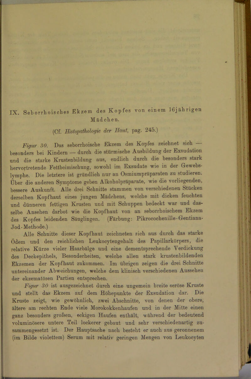 I \ IX. Seborrhoisches Ekzem des Kopfes von einem 16jährigen Mädchen. (Cf. Histopathologie der Haut, pag. 245.) Figur 30. Das seborrhoische Ekzem des Kopfes zeichnet sich besonders bei Kindern — durch die stürmische Ausbildung der Exsudation und die starke Krustenbildung aus, endlich durch die besonders stark hervortretende Fettbeimischung, sowohl im Exsudate wie in der Gewebs- lymphe. Die letztere ist gründlich nur an Osmiumpräparaten zu studieren. Über die anderen Symptome geben Alkoholpräparate, wie die vorliegenden, bessere Auskunft. Alle drei Schnitte stammen von verschiedenen Stücken derselben Kopfhaut eines jungen Mädchens, welche mit dicken feuchten und dünneren fettigen Krusten und mit Schuppen bedeckt war und das- selbe Ansehen darbot wie die Kopfhaut von an seborrhoischem Ekzem des Kopfes leidenden Säuglingen. (Färbung: Pikrocochenille-Gentiana- Jod- Methode.) Alle Schnitte dieser Kopfhaut zeichneten sich aus durch das starke Ödem und den reichlichen Leukocytengehalt des Papillarkörpers, die relative Kürze vieler Haarbälge und eine dementsprechende Verdickung des Deckepithels, Besonderheiten, welche allen stark krustenbildenden Ekzemen der Kopfhaut zukommeu. Im übrigen zeigen die drei Schnitte untereinander Abweichungen, welche dem klinisch verschiedenen Aussehen der ekzematösen Partien entsprechen. Figur 30 ist ausgezeichnet durch eine ungemein breite seröse Kruste und stellt das Ekzem auf dem Höhepunkte der Exsudation dar. Die Kruste zeigt, wie gewöhnlich, zwei Abschnitte, von denen der obere, ältere am rechten Ende viele Morokokkenhaufen und in der Mitte einen ganz besonders grofsen, eckigen Haufen enthält, während der bedeutend voluminösere untere Teil lockerer gebaut und sehr verschiedenartig zu- sammengesetzt ist. Der Hauptsache nach besteht er auch aus geronnenem (im Bilde violettem) Serum mit relativ geringen Mengen von Leukocyten