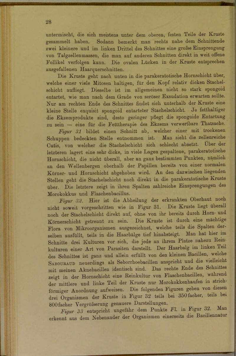 untermischt, die sich meistens unter dem oberen, festen Teile der Kruste gesammelt haben. Sodann bemerkt man rechts nahe dem Schnittende zwei kleinere und im linken Drittel des Schnittes eine grofse Einsprengung von Talgzellenmassen, die man auf anderen Schnitten direkt in weit offene Follikel verfolgen kann. Die ovalen Lücken in der Kruste entsprechen ausgefallenen Haarquerschnitten. Die Kruste geht nach unten in die parakeratotische Hornschicht über, welche einer viele Mitosen haltigen, für den Kopf relativ dicken Stachel- schicht aufliegt. Dieselbe ist im allgemeinen nicht so stark spongoid entartet, wie man nach dem Grade von seröser Exsudation erwarten sollte. Nur am rechten Ende des Schnittes findet sich unterhalb der Kruste eine kleine Stelle exquisit spongoid entarteter Stachelschicht. Je fetthaltiger die Ekzemprodukte sind, desto geringer pflegt die spongoide Entartung zu sein — eine für die Fetttherapie des Ekzems verwertbare Thatsache. Figur 31 bildet einen Schnitt ab, welcher einer mit trockenen Schuppen bedeckten Stelle entnommen ist. Man sieht die zellenreiche Cutis, von welcher die Stachelschicht sich schlecht absetzt. Über der letzteren lagert eine sehr dicke, in viele Lagen gespaltene, parakeratotische Hornschicht, die nicht überall, aber an ganz bestimmten Punkten, nämlich an den Wellenbergen oberhalb der Papillen bereits von einer normalen Körner- und Hornschicht abgehoben wird. An den dazwischen liegenden Stellen geht die Stachelschicht noch direkt in die parakeratotische Kruste über. Die letztere zeigt in ihren Spalten zahlreiche Einsprengungen des Morokokkus und Flaschenbacillus. Figur 32. Hier ist die Abheilung der erkrankten Oberhaut noch nicht soweit vorgeschritten wie in Figur 31. Die Kruste liegt überall noch der Stachelschicht direkt auf, ohne von ihr bereits durch Horn- und Körnerschicht getrennt zu sein. Die Kruste ist durch eine mächtige Flora von Mikroorganismen ausgezeichnet, welche teils die Spalten der- selben ausfüllt, teils in die Haarbälge tief hinabsteigt. Man hat hier im Schnitte drei Kulturen vor sich, die jede an ihrem Platze nahezu Rein- kulturen einer Art von Parasiten darstellt. Der Haarbalg im linken leil des Schnittes ist ganz und allein erfüllt von den kleinen Bacillen, welche Sabouhaüd neuerdings als Seborrhoebacillen anspricht und die vielleicht mit meinen Aknebacillen identisch sind. Das rechte Ende des Schnittes zeigt in der Hornschicht eine Reinkultur von Flaschenbacillen, während der mittlere und linke Teil der Kruste nur Morokokkenhaufen in strich- förmiger Anordnung aufweisen. Die folgenden Figuren geben von diesen drei Organismen der Kruste in Figur 32 teils bei 350facher, teils bei 800facher Vergrölserung genauere Darstellungen. Figur 33 entspricht ungefähr dem Punkte Fl. in Figur 32. Man erkennt aus dem Nebenander der Organismen einerseits die Bacillennatur -