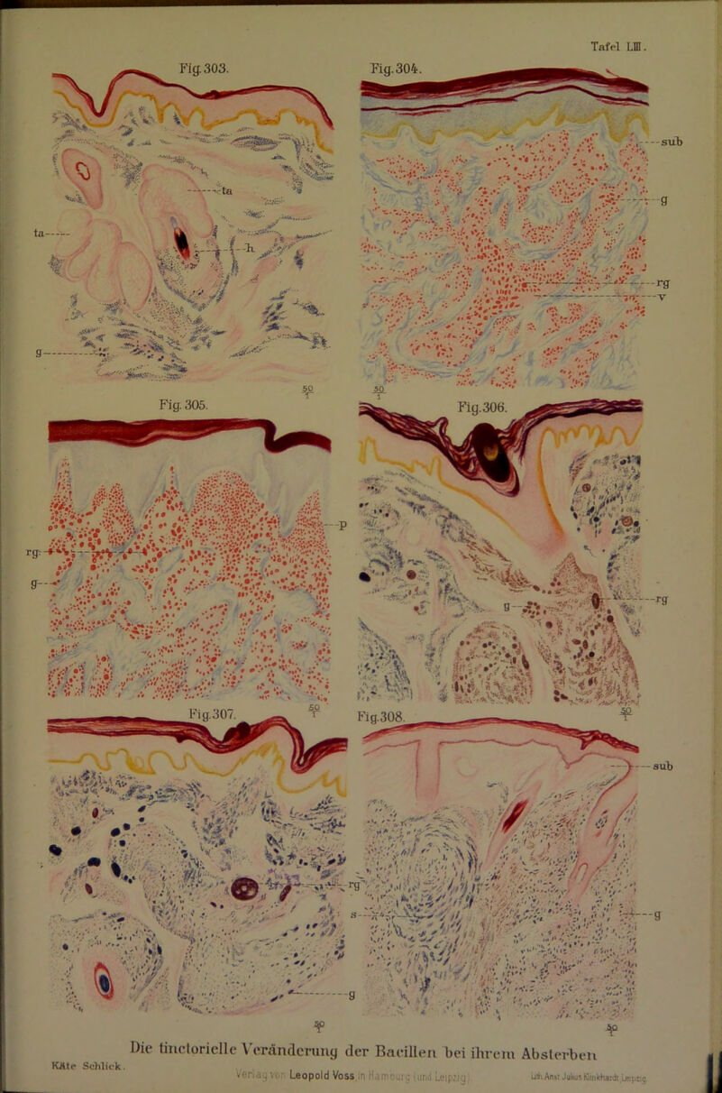 Fig. 303. Fig.304. Jl \ J y • •• V- . r .. 0:;. - sub *'* •• '■ '•,■ ■••;'• r> ... •'* * *••*-* «- •. ' . ' •*.* »■•» i; * • • • ••? •• • i ■ ••• .*• •* v* »?:• •• ■ •. *t '* ..* ‘.'•i'! «/»'i! ’i;;. .•***** * , . j •'.*!«#• *•*•*•* * *'■ ^ ■■•■•.•'s. • . •••■ mMT r. ' V •• ■ -• .■...'s „4- /.v .. . f . •■.•■ ■' .. P' % OS !• ■<! ■■ ...  r-rg , * jfc;'; (*■■■ „gm H- . ,■ . >'S. 9 --f£ * V / * ’« ■ >■ :»! ;A * Vv , V *£ «■■•.'•<; vVOoA ^ Fig. 308 ¥ Pin M07 ... ':n\iy •< ... ' vv.;! . V f' $*.'< '• si.'V ¥ ¥ KÄto Schlick. Die linctorielle Veränderung der Bacillen bei ihrem Ab sterben Leopold Voss in urq (und Leipzig utii An»t Julws Kimkha;diLjttprig ii