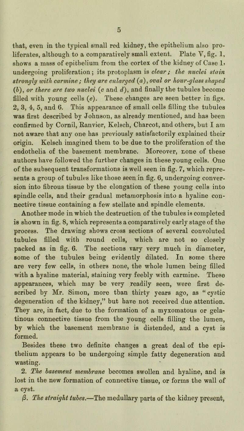 that, even in the typical small red kidney, the epithelium also pro- liferates, although to a comparatively small extent. Plate V, fig. 1, shows a mass of epithelium from the cortex of the kidney of Case 1> undergoing proliferation; its protoplasm is clear; the nuclei stain strongly luith carmine ; they are enlarged (a), oval or hour-glass shaped (b), or there are two nuclei (c and c?), and finally the tubules become filled with young cells (e). These changes are seen better in figs. 2, 3, 4, 5, and 6. This appearance of small cells filling the tubules was first described by Johnson, as already mentioned, and has been confirmed by Cornil, Panvier, Kelsch, Charcot, and others, but I am not aware that any one has previously satisfactorily explained their origin. Kelsch imagined them to be due to the proliferation of the endothelia of the basement membrane. Moreover, none of these authors have followed the further changes in these young cells. One of the subsequent transformations is well seen in fig. 7, which repre- sents a group of tubules like those seen in fig. 6, undergoing conver- sion into fibrous tissue by the elongation of these young cells into spindle cells, and their gradual metamorphosis into a hyaline con- nective tissue containing a few stellate and spindle elements. Another mode in which the destruction of the tubules is completed is shown in fig. 8, which represents a comparatively early stage of the process. The drawing shows cross sections of several convoluted tubules filled with round cells, which are not so closely packed as in fig. 6. The sections vary very much in diameter, some of the tubules being evidently dilated. In some there are very few cells, in others none, the whole lumen being filled with a hyaline material, staining very feebly with carmine. These appearances, which may be very readily seen, were first de- scribed by Mr. Simon, more than thirty years ago, as “ cystic degeneration of the kidney,” but have not received due attention. They are, in fact, due to the formation of a myxomatous or gela- tinous connective tissue from the young cells filling the lumen, by which the basement membrane is distended, and a cyst is formed. Besides these two definite changes a great deal of the epi- thelium appears to be undergoing simple fatty degeneration and wasting. 2. The basement membrane becomes swollen and hyaline, and is lost in the new formation of connective tissue, or forms the wall of a cyst. (3. The straight tubes,—The medullary parts of the kidney present.