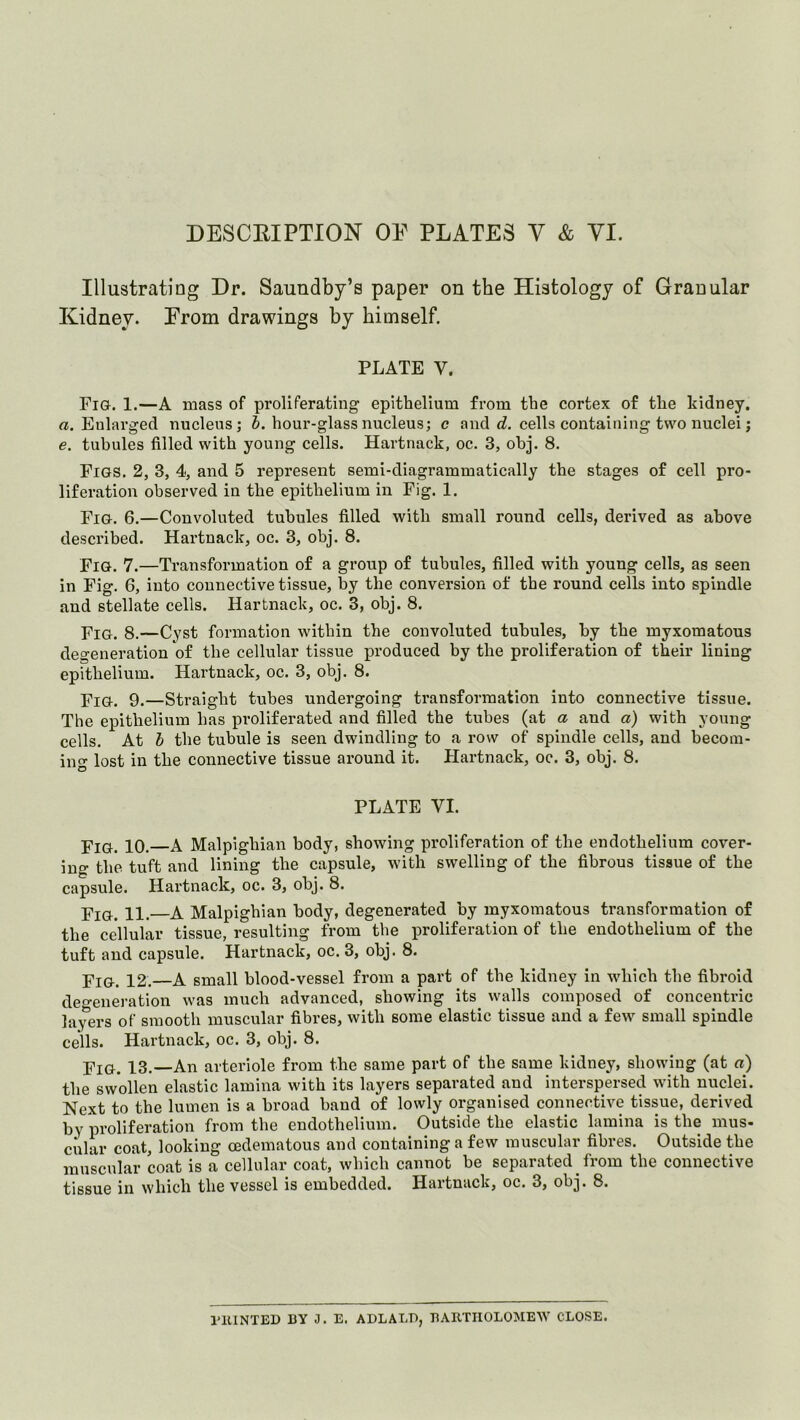 Illustrating Dr. Sauudby’s paper on the Histology of Granular Kidney. Erom drawings by himself. PLATE V. Fig. 1.—A mass of proliferating epithelium from the cortex of the kidney. a. Enlarged nucleus; J. hour-glass nucleus; c and rf. cells containing two nuclei; e. tubules filled with young cells. Hartnack, oc. 3, obj. 8. Figs. 2, 3, 4, and 5 represent semi-diagrammatically the stages of cell pro- liferation observed in the epithelium in Fig. 1. Fig. 6.—Convoluted tubules filled with small round cells, derived as above desci’ibed. Hartnack, oc. 3, obj. 8. Fig. 7.—Transformation of a group of tubules, filled with young cells, as seen in Fig. 6, into connective tissue, by the conversion of the round cells into spindle and stellate cells. Hartnack, oc. 3, obj. 8. Fig. 8.—Cyst formation witbin the convoluted tubules, by the myxomatous degeneration of the cellular tissue produced by the proliferation of their lining epithelium. Hartnack, oc. 3, obj. 8. p'lQ.. 9.—Straight tubes undergoing transformation into connective tissue. The epithelium has proliferated and filled the tubes (at a and a) with young cells. At h the tubule is seen dwindling to a row of spindle cells, and becom- ing lost in the connective tissue around it. Flartnack, oc. 3, obj. 8. PLATE VI. Fig. 10. A Malpighian body, showing proliferation of the endothelium cover- ing the tuft and lining the capsule, with swelling of the fibrous tissue of the capsule. Hartnack, oc. 3, obj. 8. 11, A Malpighian body, degenerated by myxomatous transformation of the cellular tissue, resulting from the proliferation of the endothelium of the tuft and capsule. Hartnack, oc. 3, obj. 8. Fig. 12. A small blood-vessel from a part of the kidney in which the fibroid deo-eneration was much advanced, showing its walls composed of concentric layers of smooth muscular fibres, with some elastic tissue and a few small spindle cells. Hartnack, oc. 3, obj. 8. Fig. 13.—An arteriole from the same part of the same kidney, showing (at a) the swollen elastic lamina with its layers separated and interspersed with nuclei. Next to the lumen is a broad baud of lowly organised connective tissue, derived by proliferation from the endothelium. Outside the elastic lamina is the mus- cular coat, looking cedematous and containing a few muscular fibres. Outside the muscular coat is a cellular coat, which cannot be separated from the connective tissue in which the vessel is embedded. Hartnack, oc. 3, obj. 8. I'llINTED BY J. E. ADLALI), BARTHOLOMEW CLOSE.