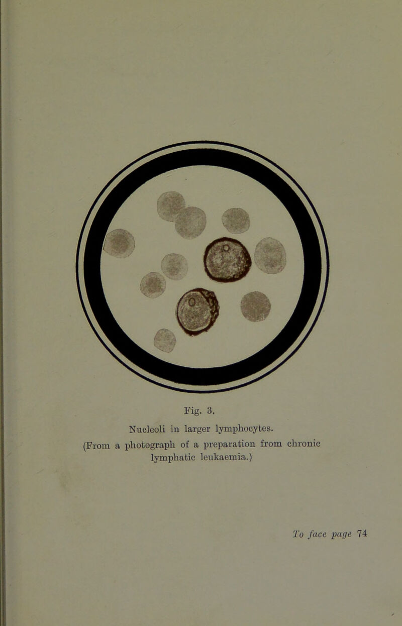 Nucleoli in larger lymphocytes. (From a photograph of a preparation from chronic lymphatic leukaemia.)