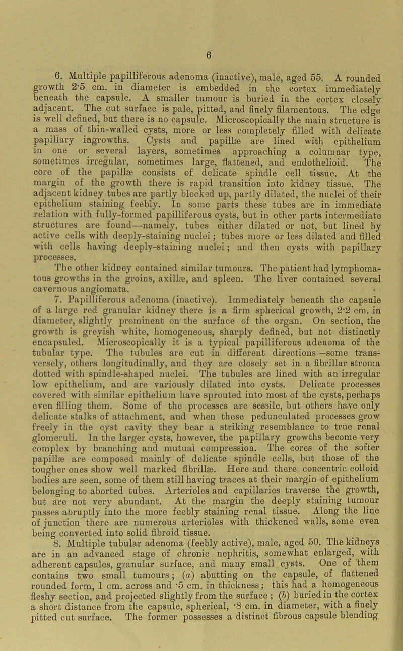 6. Multiple papilliferous adenoma (inactive), male, aged 55. A rounded growth 2'5 cm. in diameter is embedded in the cortex immediately beneath the capsule. A smaller tumour is buried in the cortex closely adjacent. The cut surface is pale, pitted, and finely filamentous. The edge is well defined, but there is no capsule. Microscopically the main structure is a mass of thin-walled cysts, more or less completely filled with delicate papillary ingrowths. Cysts and papillae are lined with epithelium in one or^ several layers, sometimes approaching a columnar type, sometimes irregular, sometimes large, flattened, and endothelioid. The core of the papillae consists of delicate spindle cell tissue. At the margin of the growth there is rapid transition into kidney tissue. The adjacent kidney tubes are partly blocked up, partly dilated, the nuclei of their epithelium staining feebly. In some parts these tubes are in immediate relation with fully-formed papilliferous cysts, but in other parts intermediate structures are found—namely, tubes either dilated or not, but lined by active cells with deeply-staining nuclei; tubes more or less dilated and filled with cells liaving deeply-staining nuclei; and then cysts Avith papillary processes. 'I’he other kidney contained similar tumours. The patient had lymphoma- tous growths in the groins, axillaj, and spleen. The liver contained several cavernous angiomata. 7. Papilliferous adenoma (inactive). Immediately beneath the capsule of a large red granular kidney there is a firm spherical growth, 2’2 cm. in diameter, slightly prominent on the surface of the organ. On section, the growth is greyish white, homogeneous, sharply defined, but not distinctly encapsuled. Microscopically it is a typical papilliferous adenoma of the tubular type. The tubules are cut in different directions —some trans- versely, others longitudinally, and they are closely set in a fibrillar stroma dotted with spindle-shaped nuclei. The tubules are lined with an irregular loAV epithelium, and are variously dilated into cysts. Delicate processes covered with similar epithelium have sprouted into most of the cysts, perhaps even filling them. Some of the processes are sessile, but others have only delicate stalks of attachment, and when these pedunculated processes groAV freely in the cyst cavity they bear a striking resemblance to true renal glomeruli. In the larger cysts, however, the papillary growths become very complex by branching and mutual comjjression. The cores of the softer papillae are composed mainly of delicate spindle cells, but those of the tougher ones show well marked fibrillae. Here and there concentric colloid bodies are seen, some of them still having traces at their margin of epithelium belonging to aborted tubes. Arterioles and capillaries traverse the groAvth, but are not very abundant. At the margin the deeply staining tumour passes abruptly into the more feebly staining renal tissue. Along the line of junction there are numerous arterioles with thickened Avails, some even being converted into solid fibroid tissue. 8. Multiple tubular adenoma (feebly active), male, aged 50. The kidneys are in an adA'anced stage of chronic nephritis, someAvhat enlarged, with adherent capsules, granular surface, and many small cysts. One of them contains two small tumours; (a) abutting on the capsule, of flattened rounded form, 1 cm. across and ’5 cm. in thickness; this had a homogeneous fleshy section, and projected slightly from the surface ; (b) buried in the cortex a short distance from the capsule, spherical, ‘8 cm. in diameter, Avith a finely pitted cut surface. The former possesses a distinct fibrous capsule blending