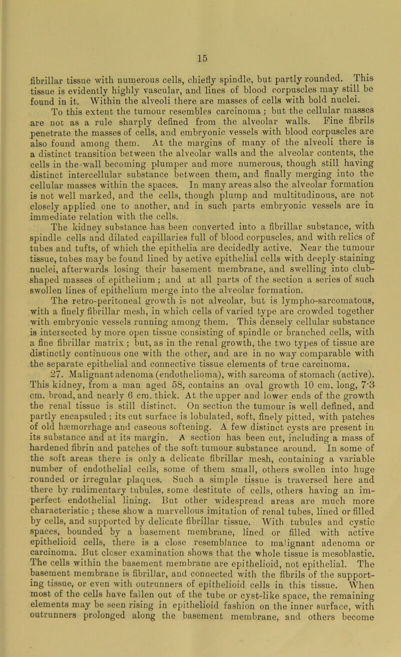 fibrillar tissue with numerous cells, chiefly spindle, but partly rounded. This tissue is evidently highly vascular, and lines of blood corpuscles may still be found in it. Within the alveoli there are masses of cells with bold nuclei. To this extent the tumour resembles carcinoma ; but the cellular masses are not as a rule sharply defined from the alveolar walls. Fine fibrils penetrate the masses of cells, and embryonic vessels with blood corpuscles are also found among them. At the margins of many of the alveoli there is a distinct transition between the alveolar walls and the alveolar contents, the cells in the wall becoming plumper and more numerous, though still having distinct intercellular substance between them, and finally merging into the cellular masses within the spaces. In many areas also the alveolar formation is not well marked, and the cells, though plump and multitudinous, are not closely applied one to another, and in such parts embryonic vessels are in immediate relation with the cells. The kidney substance has been converted into a fibrillar substance, with spindle cells and dilated capillaries full of blood corpuscles, and with relics of tubes and tufts, of which the epithelia are decidedly active. Near the tumour tissue, tubes may be found lined by active epithelial cells with deeply-staining nuclei, afterwards losing their basement membrane, and swelling into club- shaped masses of epithelium; and at all parts of the section a series of such swollen lines of epithelium merge into the alveolar formation. The retro-peritoneal growth is not alveolar, but is lympho-sarcomatous, with a finely fibrillar mesh, in which cells of varied type are crowded together wdth embryonic vessels running among them. This densely cellular substance is intersected by more open tissue consisting of spindle or branched cells, with a fine fibrillar matrix ; but, as in the renal growth, the two types of tissue are distinctly continuous one with the other, and are in no way comparable with the separate epithelial and connective tissue elements of true carcinoma. 27. Malignant adenoma (endothelioma), with sarcoma of stomach (active). This kidney, from a man aged 58, contains an oval growth 10 cm. long, 7‘S cm. broad, and nearly 6 cm. thick. At the upper and lower ends of the growth the renal tissue is still distinct. On section the tumour is well defined, and partly encapsuled ; its cut surface is lobulated, soft, finely pitted, with patches of old haemorrhage and caseous softening. A few distinct cysts are present in its substance and at its margin. A section has been cut, including a mass of hardened fibrin and patches of the soft tumour substance around. In some of the soft areas there is only a delicate fibrillar mesh, containing a variable number of endothelial cells, some of them small, others swollen into huge rounded or irregular plaques. Such a simple tissue is traversed here and there by rudimentary tubules, some destitute of cells, others having an im- perfect endothelial lining. But other widespread areas are much more characteristic; these show a marvellous imitation of renal tubes, lined or filled by cells, and supported by delicate fibrillar tissue. With tubules and cystic spaces, bounded by a basement membrane, lined or filled with active epithelioid cells, there is a close resemblance to malignant adenoma or carcinoma. But closer examination shows that the whole tissue is mesoblastic. The cells within the basement membrane are epithelioid, not epithelial. The basement membrane is fibrillar, and connected with the fibrils of the support- ing tissue, or even with outrunners of epithelioid cells in this tissue. When most of the cells have fallen out of the tube or cyst-like space, the remaining elements may be seen rising in epitlielioid fashion on the inner surface, with outrunners prolonged along the basement membrane, and others become