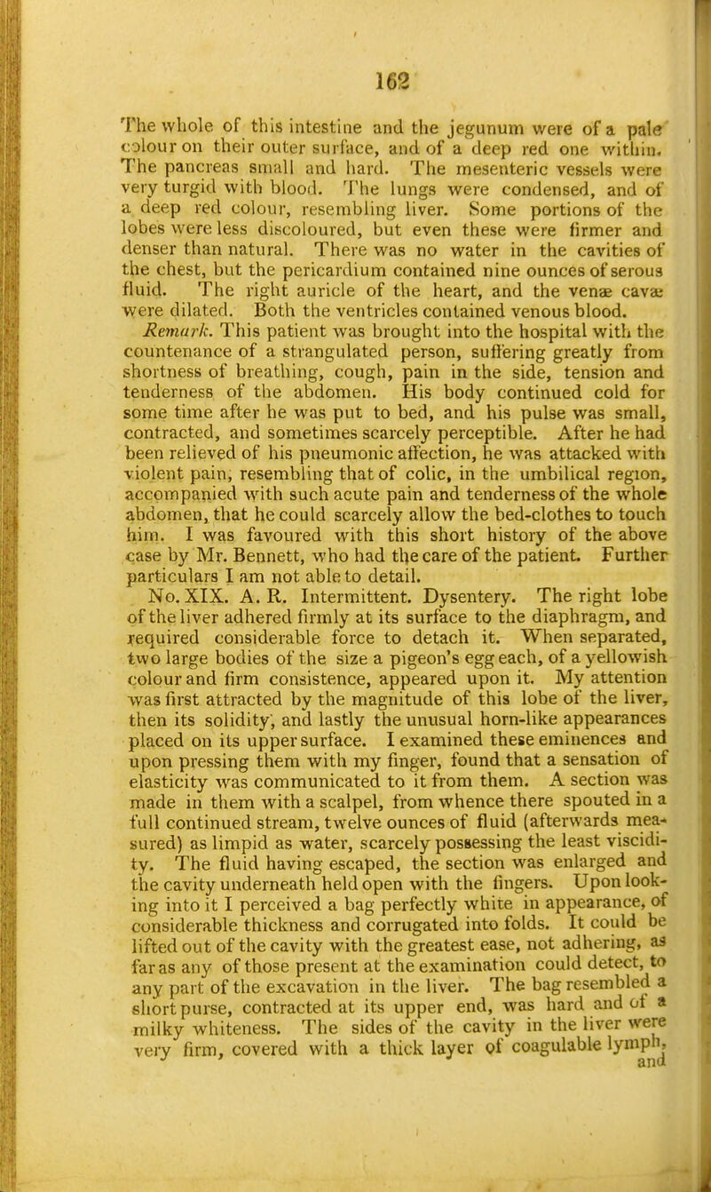 The whole of this intesthie and the jegunum were of a pale colour on their outer surface, and of a deep red one within. The pancreas small and hard. The mesenteric vessels were very turgid with blood. The lungs were condensed, and of a deep red colour, resembling liver. Some portions of the lobes were less discoloured, but even these were firmer and denser than natural. There was no water in the cavities of the chest, but the pericardium contained nine ounces of serous fluid. The right auricle of the heart, and the venae cavae were dilated. Both the ventricles contained venous blood. Remark. This patient was brought into the hospital with the countenance of a strangulated person, suffering greatly from shortness of breathing, cough, pain in the side, tension and tenderness of the abdomen. His body continued cold for some time after he was put to bed, and his pulse was small, contracted, and sometimes scarcely perceptible. After he had been relieved of his pneumonic affection, he was attacked wnth violent pain, resembling that of colic, in the umbilical region, accpiTipanied with such acute pain and tenderness of the whole abdomen, that he could scarcely allow the bed-clothes to touch him. I was favoured with this short history of the above case by Mr. Bennett, who had the care of the patient. Further particulars I am not able to detail. No. XIX. A. R. Intermittent. Dysentery. The right lobe of the liver adhered firmly at its surface to the diaphragm, and required considerable force to detach it. When separated, two large bodies of the size a pigeon's egg each, of a yellowish colour and firm consistence, appeared upon it. My attention was first attracted by the magnitude of this lobe of the liver, then its solidity, and lastly the unusual horn-like appearances placed on its upper surface. I examined these eminences and upon pressing them with my finger, found that a sensation of elasticity w^as communicated to it from them. A section was made in them with a scalpel, from whence there spouted in a full continued stream, twelve ounces of fluid (afterwards mea- sured) as limpid as water, scarcely possessing the least viscidi- ty. The fluid having escaped, the section was enlarged and the cavity underneath held open with the fingers. Upon look- ing into it I perceived a bag perfectly white in appearance, of considerable thickness and corrugated into folds. It could be lifted out of the cavity with the greatest ease, not adhering, as far as any of those present at the exaiTiination could detect, to any part of the excavation in the liver. The bag resembled a short purse, contracted at its upper end, was hard and of a milky whiteness. The sides of the cavity in the liver were very firm, covered with a thick layer of coagulable lymph.