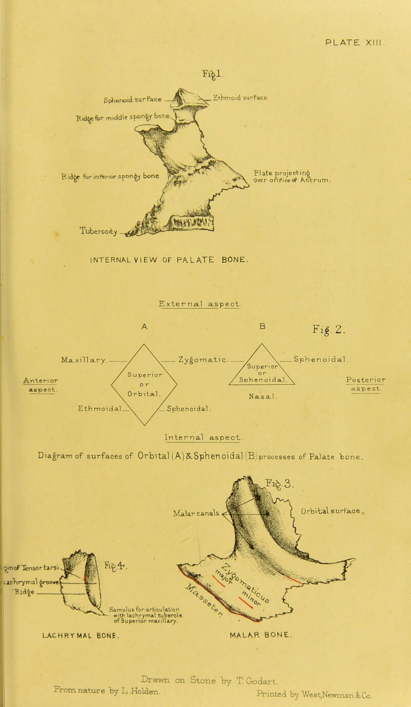 Fi^.l gpbenoid surface . -4 Ethmoid surface R.dgefor middle spongy bonev Ridge for inferior spongy bone 7*^-1 , Tuberosity Jm Plate projecting over orificeof Antrum. INTERNAL VIEW OF PALATE BONE. External aspect. A B Fig- 2. Maxill ary. Anterior aspect. Zygornati C Sph e n oi d al. Nasal. Posterior aspect. Ethmoidal—X /_Sphenoidal Internal aspect. Diagram of surfaces of Orbital (A)&Sphenoidal (Bjprocesses of Palate bone. Malar canals Orbital surface . gmof Tensor tarsi • achrymal groove '■Ridge Hamulus for articulation '-<* with lachrymal tubercle C* of Superior maxillary. LACHRYMAL BONE. MALAR BONE. Drawn on Stone by T. Godart. From nature by L Holden Printed by West,Newman k Co.