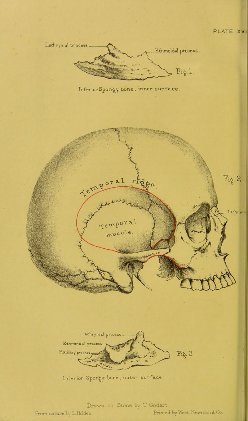 PLATE XV Lachrymal InPenorSponi^yEone, inner surface. process ^ Ethmoidal process. P^.l. ^.3. Inferior Spongy bone, outer surface Lachrymal process E'kTrmcnda] p-rocess Maxillctry process Drawn on Stone by T. Go dart From nature by L Holder Printed by West, N ewmai 16c Co.