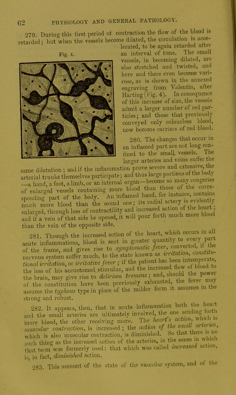 Fig. 4. retarded: but when the vessels become dilated, the circulation is acce- lerated, to be again retarded after an interval of time. The small vessels, in becoming dilated, are also stretched and twisted, and here and there even become vari- cose, as is shown in the annexed engraving from Valentin, after Harting (big. 4). In consequence of this increase of size, the vessels admit a larger number of red par- ticles ; and those that previously conveyed only colourless blood, now become carriers of red blood. 280. The changes that occur in an inflamed part are not long con- fined to the small vessels. The larger arteries and veins suffer the same dilatation ; and if the inflammation prove severe and extensive, the arterial trunks themselves participate; and thus large portions of the body —a hand, a foot, a limb, or an internal organ—become so many convenes of enlarged vessels containing more blood than those of the coi re- sponding part of the body. An inflamed hand, for instance, contains much more blood than the sound one; its radial F Is •. enlarged, through loss of contractility and increased action of the heai , and if a vein of that side be opened, it will pour forth much more blood than the vein of the opposite side. 281. Through the increased action of the heart, which occurs in all acute inflammations, blood is sent in greater quanta y o e'J1 • .J1, of the frame, and gives rise to symptomatic nervous system suffer much, to the state known as station,* “ “ ‘ tional irritation, or irritative fever ; if the patient has been intern peiate the loss of his accustomed stimulus, and the increased flow of blood to the brain, may give rise to delirium tremens ; and, should P» of the constitution have been previously exhausted, the assume the typhous type in place of the milder foirn i < strong and robust. 282. It appears, then, that in acute inflammation both the heart and the small arteries are ultimately involved, the one sendm » more blood, the other receiving more. The hearts Mtton, \\ 11 * muscular contraction, is increased; the action of the . ’ which is also muscular contraction, is diminished. So that the such thin0' as the increased action of the arteries, in the sense in w nc i that term=was formerly used: that which was called increased ac ion, is, in fact, diminished action. °83. This account of the state of the vascular system, and ot the