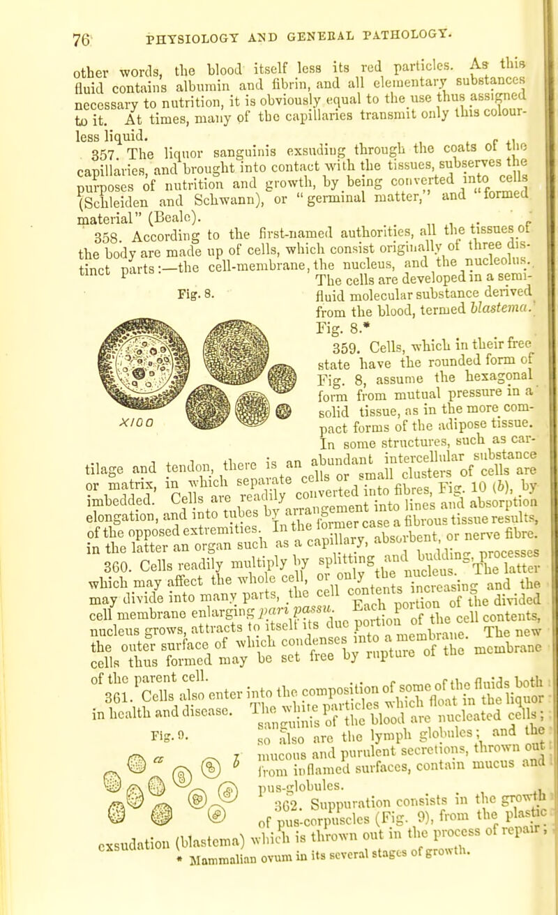 XlOO Other words, the blood itself less its red particles. As this fluid contains albumin and fibrin, and all elementary substances necessary to nutrition, it is obviously equal to the use thus assigned to it. At times, many of the capillanes transmit only this colour- less liquid, . f 41 357 The liquor sanguinis exsuding through the coats ot tiie capillaries, and brought into contact with the tissues subserves the purposes of nutrition and growth, by being o. (Schleiden and Schwann), or  germinal matter, and formed material (Bealo). ' ' ' 358 According to the first-named authorities, all the tissues of the body are made up of cells, which consist originallv of three dis- tinct parts—the cell-membrane,the nucleus, and the nucleolus, tmci pai ^^jj^ developed in a semi- Fig. 8. fluid molecular substance denved from the blood, termed llastema.' Fig. 8.• 359. Cells, which in their free state have the rounded form of Fig. 8, assume the hexagonal form from mutual pressure in a' solid tissue, as in the more com- pact forms of the adipose tissue. In some structures, such as car- tPndnn there is an abundant intercellular substance rSch se ai-ate cells - ^mall clusters of ceUs are imbedded. Cells are readily -v-^ed-^^^^^^^^^^ elongation, and into tubes -Ta. gem^^^^^^^^^^ ^S::^^ -SnW, absorbent .ne.e fibre 360. Cells readily multiply by ^t^^-S^^^tS '^^^^^^^ which may affect the who e cell ° .easing and the may divide into many parts, the cell '^o^;^ i^,e divided cell membrane enlarging f^^f, ^ port on o the cell contents, nucleus grows, attracts o itselt i s due 1^°'*'° The new JjLt^L^t^t s-tri;:npi;?:^;he membrane ^^SrS^f-enterintotheeomposUmnofs^eo^^ i.liealthanddisease. ^HSl^^Ste^llii^JS c^ls; ,0 also are the lymph globules ; and the mucous and purulent secretions, thrown out I vom in named surfaces, contain mucus and 1 §W G) pus-globules. ^ 3G2. Suppuration consists in the groTN-thi ^ @ ® of pus-corpuscles (Fig- 9), from the plastic. cxsudation (blastema) whiA is thrown out in the process of repair. . Mammaliau ovum in its Boveral stages of growth. tilage and or matrix, imbedded. Fifr. 0.