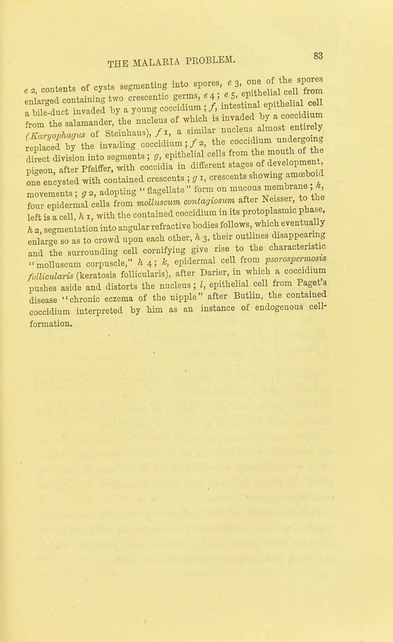 e., contents of cysts segmenting into / S^J^^^.! cilT; enlareed containing two crescentic germs, 64; «S. 'P'*, ''^V^'! , °,, riile duct tavaded by a young coccidium ; /, intestinal epithel.al cell t Lrande/tlae'nucfeus of wMc. is invaded ^7 -o^^^ (Kaniophagus of Steinliaus),/i, a similar nucleus almost entirely re^Sed by the invading coccidium;/., the coccidium mlergo ng d S cSviL into segments ; g, epithelial cells from the J o^e pigeon, after Pfeiffer, with coccidia in different stages of deve opment one en;ysted with contained crescents ; g i, crescents showmg ammboul movements; g 2, adopting - flagellate form on mucous membrane h four epidermal cells from molluscuw, contagiosmi after Neisser, to the left is a cell, h i, with the contained coccidium in its protoplasmic phase, h 2, segmentation into angular refractive bodies follows, which eventually enlarge so as to crowd upon each other, h 3, their outlines disappeanng and the surrounding cell cornifying give rise to the characteristic molluscum corpuscle, h h, epidermal cell from psorospeniwsis follicularis (keratosis follicularis), after Darier, in which a coccidium pushes aside and distorts the nucleus; I, epithelial cell from Pagets disease chronic eczema of the nipple after Butlin, the contamed coccidium interpreted by him as an instance of endogenous cell- formation.