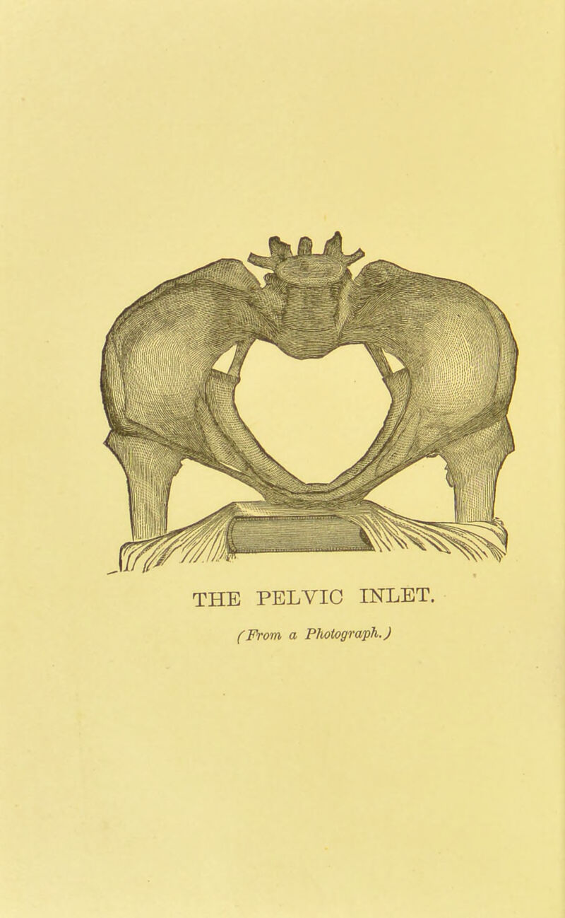 THE PELVIC INLET. (From a Photograph.)