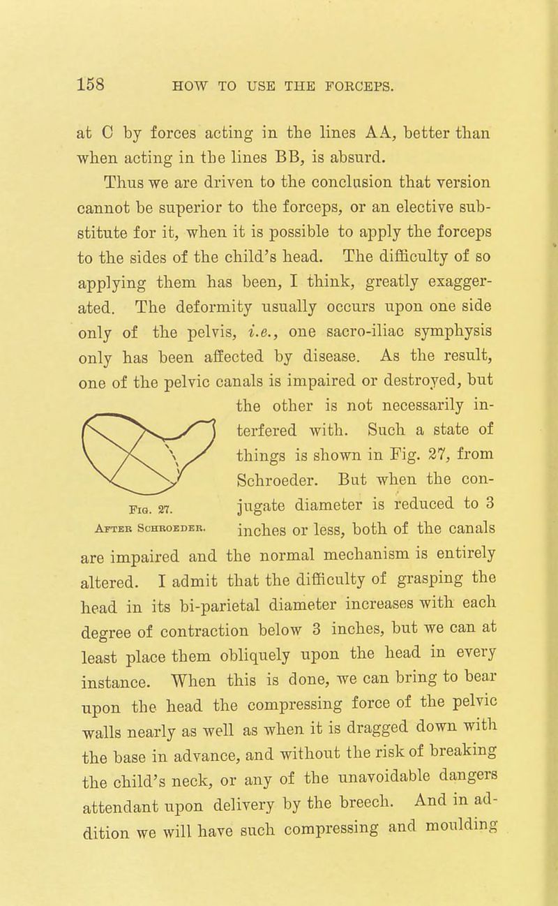 at C by forces acting in the lines A A, better than when acting in the lines BB, is absurd. Thus we are driven to the conclusion that version cannot be superior to the forceps, or an elective sub- stitute for it, when it is possible to apply the forceps to the sides of the child's head. The difficulty of so applying them has been, I think, greatly exagger- ated. The deformity usually occurs upon one side only of the pelvis, i.e., one saero-iliac symphysis only has been affected by disease. As the result, one of the pelvic canals is impaired or destroyed, but the other is not necessarily in- terfered with. Such a state of things is shown in Fig. 27, from Schroeder. But when the con- jugate diameter is reduced to 3 After schsoedeb. inches or Icss, both of the canals are impaired and the normal mechanism is entirely altered. I admit that the difficulty of grasping the head in its bi-parietal diameter increases with each degree of contraction below 3 inches, but we can at least place them obliquely upon the head in every instance. When this is done, we can bring to bear upon the head the compressing force of the pelvic walls nearly as well as when it is dragged down with the base in advance, and without the risk of breaking the child's neck, or any of the unavoidable dangers attendant upon delivery by the breech. And in ad- dition we will have such compressing and moulding