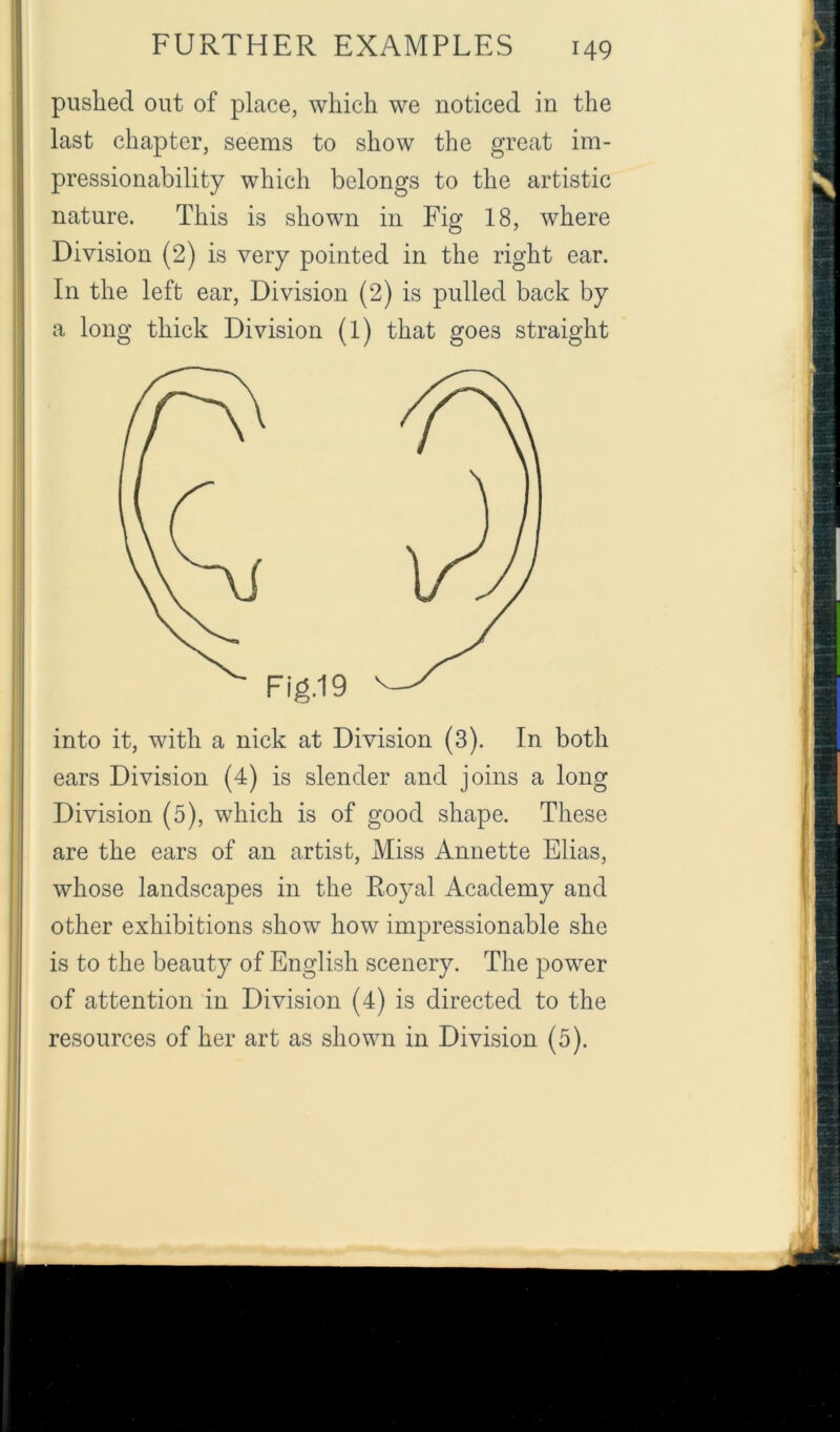 pushed out of place, which we noticed in the last chapter, seems to show the great im- pressionability which belongs to the artistic nature. This is shown in Fig 18, where Division (2) is very pointed in the right ear. In the left ear. Division (2) is pulled back by a long thick Division (1) that goes straight ears Division (4) is slender and joins a long Division (5), which is of good shape. These are the ears of an artist. Miss Annette Elias, whose landscapes in the Royal Academy and other exhibitions show how impressionable she is to the beauty of English scenery. The power of attention in Division (4) is directed to the resources of her art as shown in Division (5).