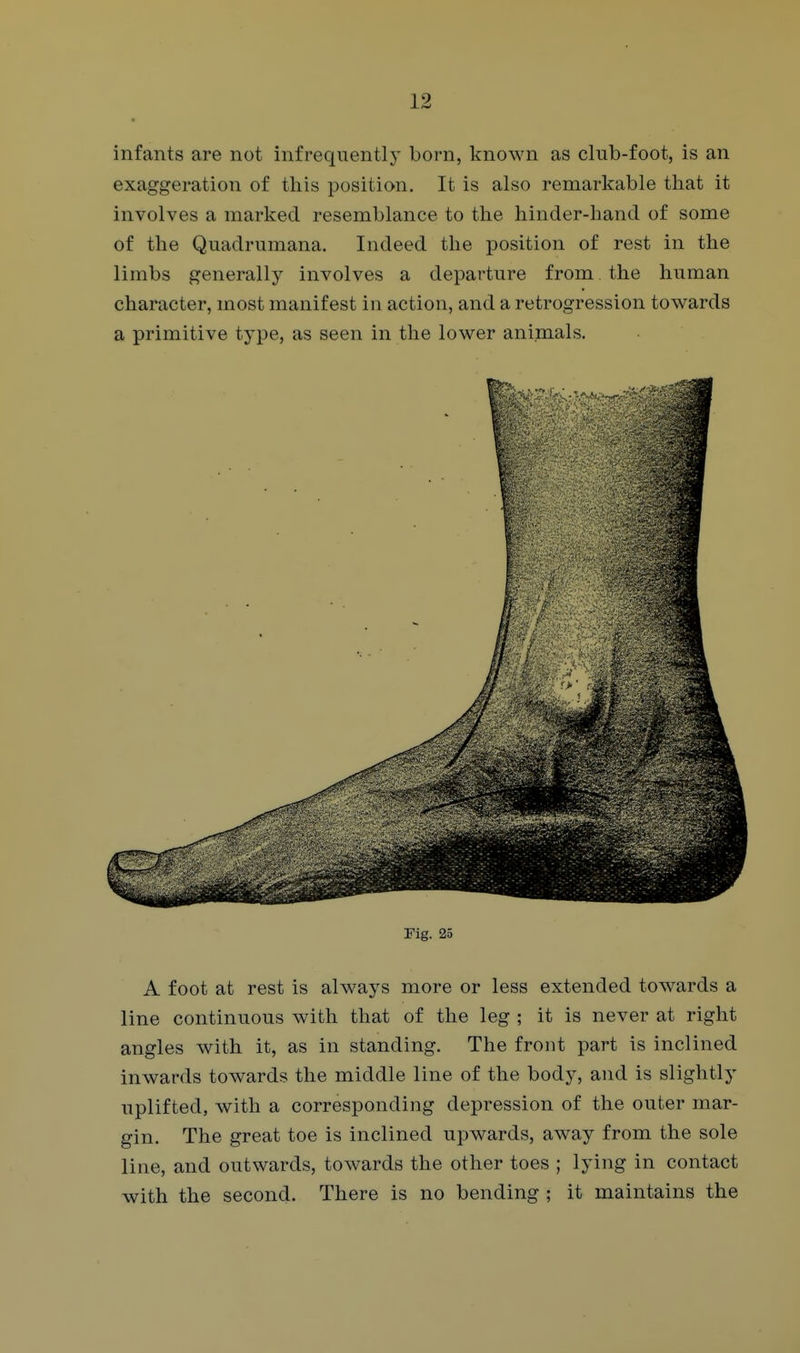 infants are not infrequently born, known as club-foot, is an exaggeration of this position. It is also remarkable that it involves a marked resemblance to the hinder-hand of some of the Quadrumana. Indeed the position of rest in the limbs generally involves a departure from the human character, most manifest in action, and a retrogression towards a primitive type, as seen in the lower animals. rig. 25 A foot at rest is always more or less extended towards a line continuous with that of the leg ; it is never at right angles with it, as in standing. The front part is inclined inwards towards the middle line of the body, and is slightly uplifted, with a corresponding depression of the outer mar- gin. The great toe is inclined upwards, away from the sole line, and outwards, towards the other toes ; lying in contact with the second. There is no bending ; it maintains the