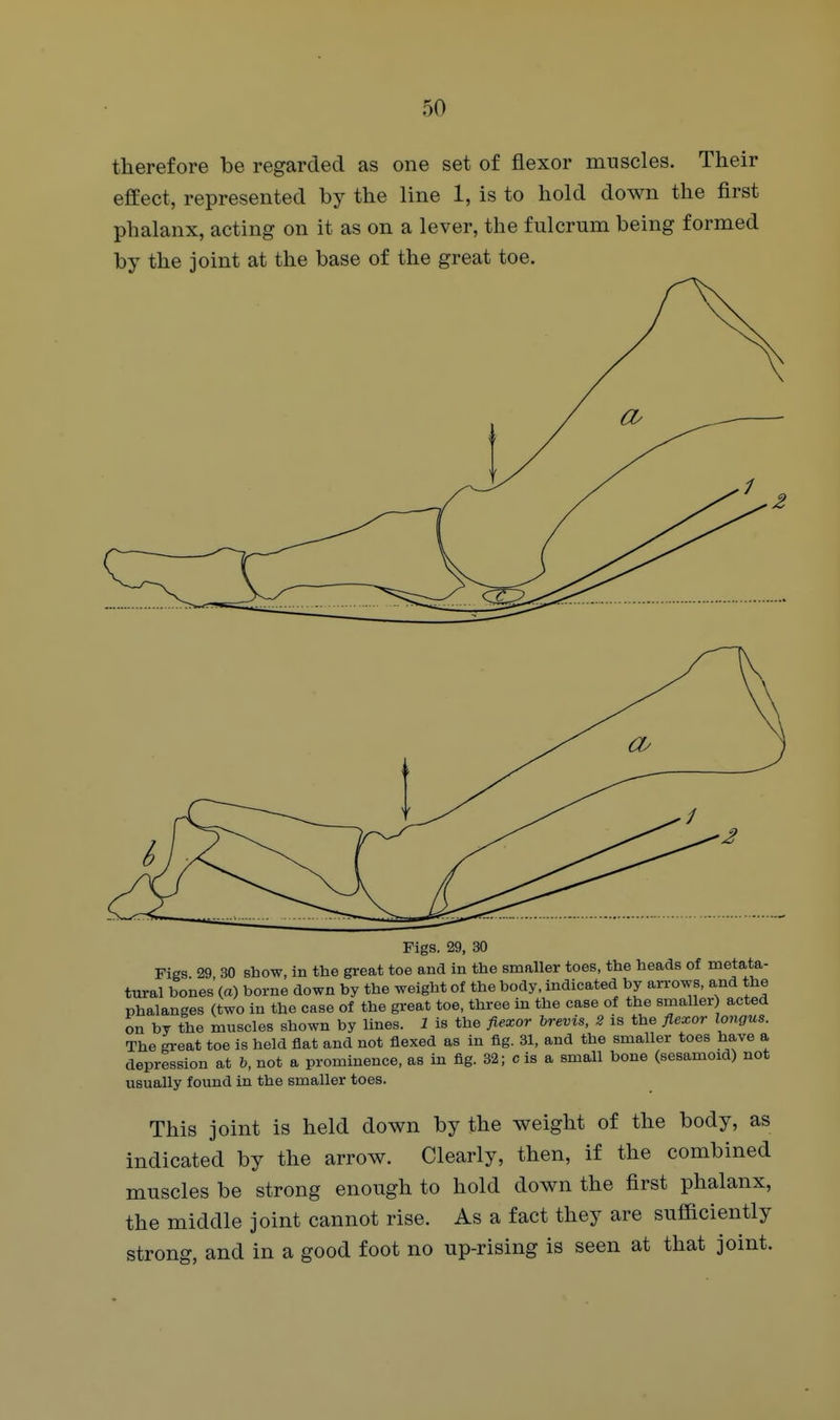 therefore be regarded as one set of flexor muscles. Their efiEect, represented by the line 1, is to hold down the first phalanx, acting on it as on a lever, the fulcrum being formed by the joint at the base of the great toe. ay i Figs. 29, 30 Figs 29 30 show, in the great toe and in the smaller toes, the heads of metata- tTiral bones'(a) borne down by the weight of the body, indicated by arrows, and the phalanges (two in the case of the great toe, three in the case of the smaller acted on by the muscles shown by lines. 1 is the flexor brevis, 2 is the flexor longus. The great toe is held flat and not flexed as in fig. 31, and the smaller toes have a depression at b, not a prominence, as in fig. 32; c is a small bone (sesamoid) not usually found in the smaller toes. This joint is held down by the weight of the body, as indicated by the arrow. Clearly, then, if the combined muscles be strong enough to hold down the first phalanx, the middle joint cannot rise. As a fact they are sufficiently strong, and in a good foot no up-rising is seen at that joint.