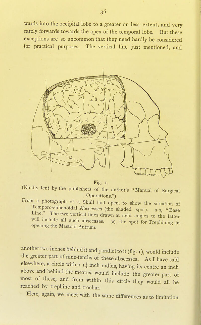 wards into the occipital lobe to a greater or less extent, and very rarely forwards towards the apex of the temporal lobe. But these exceptions are so uncommon that they need hardly be considered for practical purposes. The vertical line just mentioned, and Fig. I. (Kindly lent by the publishers of the author's Manual of Surgical Operations.) Proni a photograph of a Skull laid open, to show the situation of Temporo-sphenoidal Abscesses (the shaded spot), a a, Base Line. The two vertical lines drawn at right angles to the latter will include all such abscesses, x, the spot for Trephining in opening the Mastoid Antrum. another two inches behind it and parallel to it (fig. i), would include the greater part of nine-tenths of these abscesses. As I have said elsewhere, a circle with a i| inch radius, having its centre an inch above and behind the meatus, would include the greater part of most of these, and from within this circle they would all be reached by trephine and trochar. Heie, again, we. meet with the same differences as to limitation