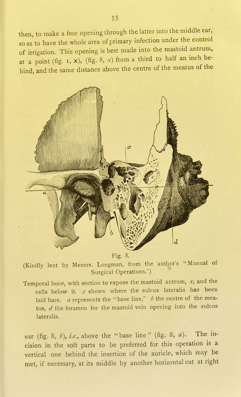 then, to make a free opening ihrough the latter into the middle ear, so as to have the whole area of primary infection under the control of irrigation. This opening is best made into the mastoid antrum, at a point (fig. i, x), (fig. 8. x) from a third to half an inch be- hind, and the same distance above the centre of the meatus of the Fig. 8. (Kindly lent by Messrs. Longman, from the author's Manual of Surgical Operations.) Temporal bone, with section to expose the mastoid antrum, x, and the cells below it. c shows where the sulcus lateralis has been laid bare, a represents the base line, d the centre of the mea- tus, d the foramen for the mastoid vein opening into the sulcus lateralis. ear (fig. 8, b), i.e., above the base line (fig. 8, a). The in- cision in the soft parts to be preferred for this operation is a vertical one behind the insertion of the auricle, which may be met, if necessary, at its middle by another horizontal cut at right