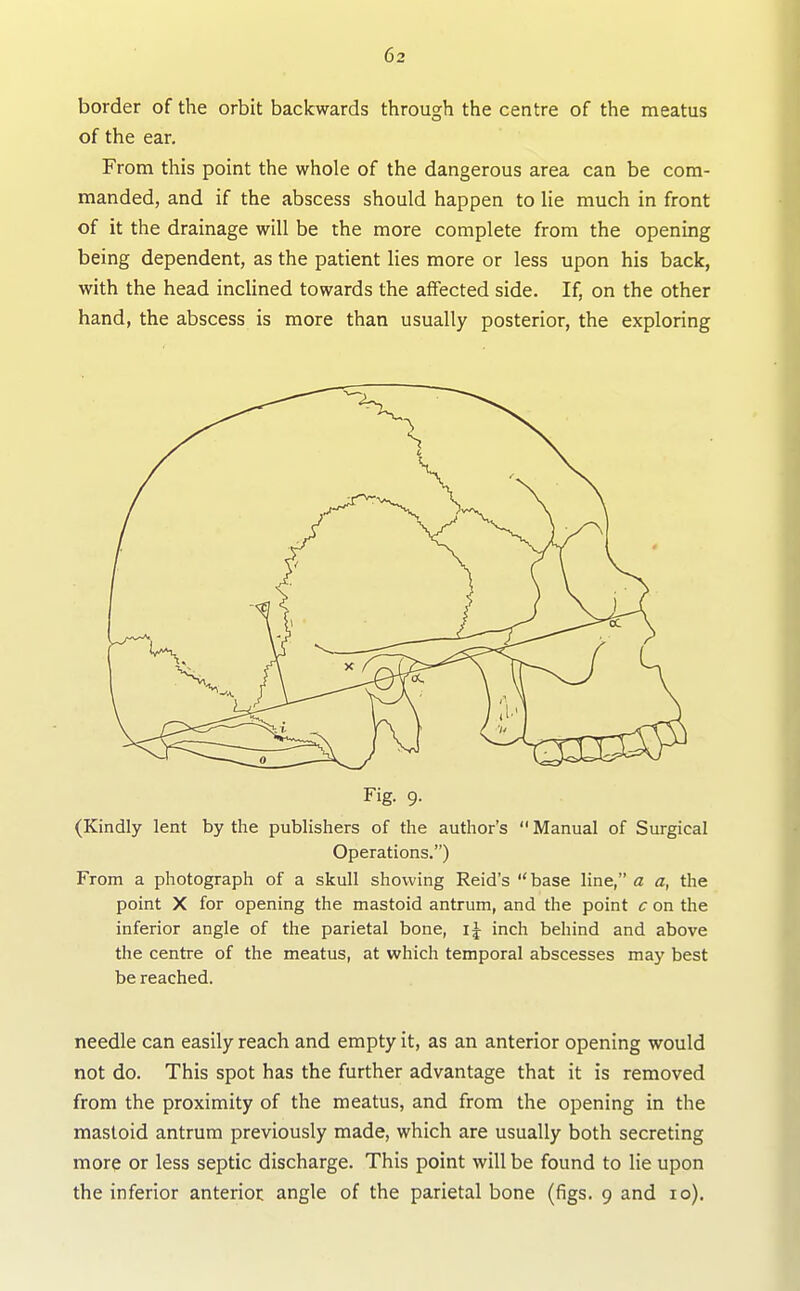 border of the orbit backwards through the centre of the meatus of the ear. From this point the whole of the dangerous area can be com- manded, and if the abscess should happen to lie much in front of it the drainage will be the more complete from the opening being dependent, as the patient lies more or less upon his back, with the head inclined towards the affected side. If, on the other hand, the abscess is more than usually posterior, the exploring Fig. 9. (Kindly lent by the publishers of the author's Manual of Surgical Operations.) From a photograph of a skull showing Reid's base line, a a, the point X for opening the mastoid antrum, and the point c on the inferior angle of the parietal bone, \\ inch behind and above the centre of the meatus, at which temporal abscesses may best be reached. needle can easily reach and empty it, as an anterior opening would not do. This spot has the further advantage that it is removed from the proximity of the meatus, and from the opening in the mastoid antrum previously made, which are usually both secreting more or less septic discharge. This point will be found to lie upon the inferior anterior angle of the parietal bone (figs. 9 and 10).