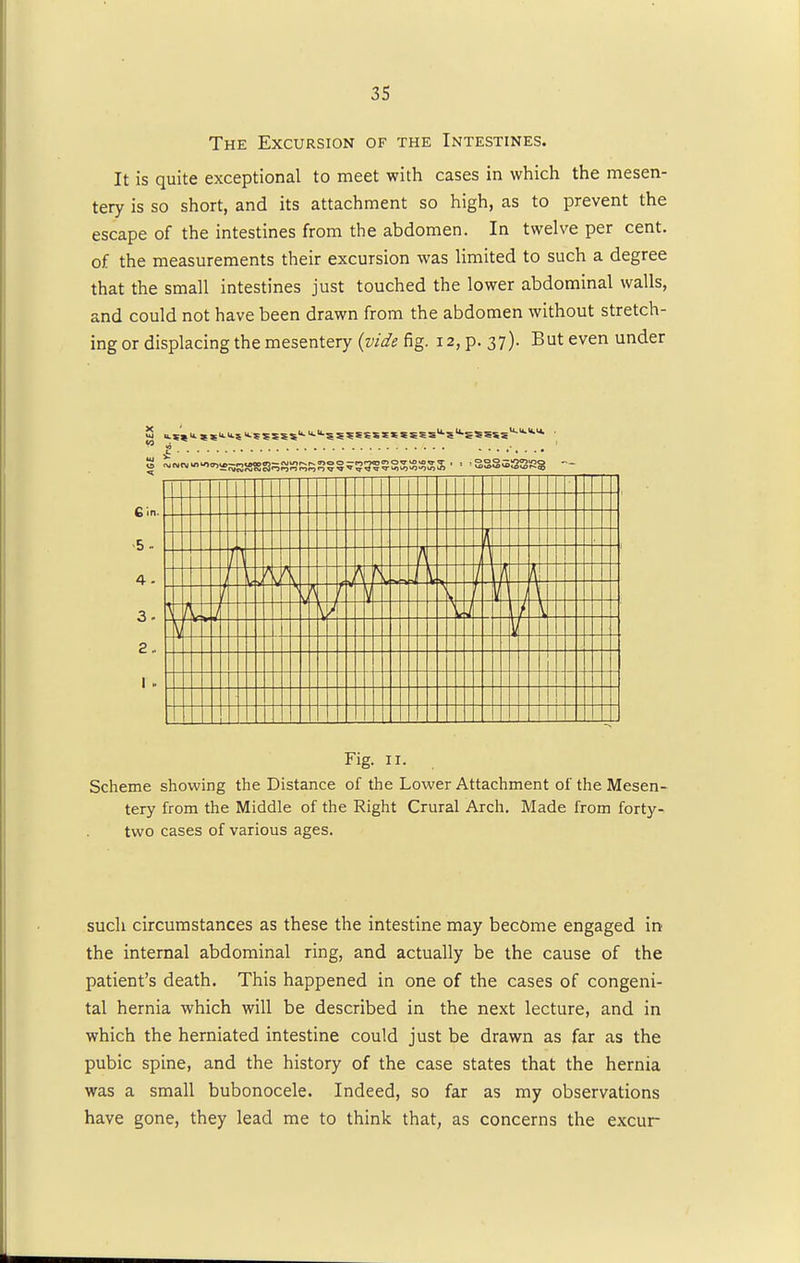 The Excursion of the Intestines. It is quite exceptional to meet with cases in which the mesen- tery is so short, and its attachment so high, as to prevent the escape of the intestines from the abdomen. In twelve per cent, of the measurements their excursion was limited to such a degree that the small intestines just touched the lower abdominal walls, and could not have been drawn from the abdomen without stretch- ing or displacing the mesentery (vide fig. 12, p. 37). But even under 5 u.seu. S5u.u.su.5SsSSK^^5S5SSSSSSESSu-Su-ES5SSU-u-1 £ I \ I \ L V A A A V \- V \ I V i 1 V I Fig. 11. Scheme showing the Distance of the Lower Attachment of the Mesen- tery from the Middle of the Right Crural Arch. Made from forty- two cases of various ages. such circumstances as these the intestine may become engaged in the internal abdominal ring, and actually be the cause of the patient's death. This happened in one of the cases of congeni- tal hernia which will be described in the next lecture, and in which the herniated intestine could just be drawn as far as the pubic spine, and the history of the case states that the hernia was a small bubonocele. Indeed, so far as my observations have gone, they lead me to think that, as concerns the excur
