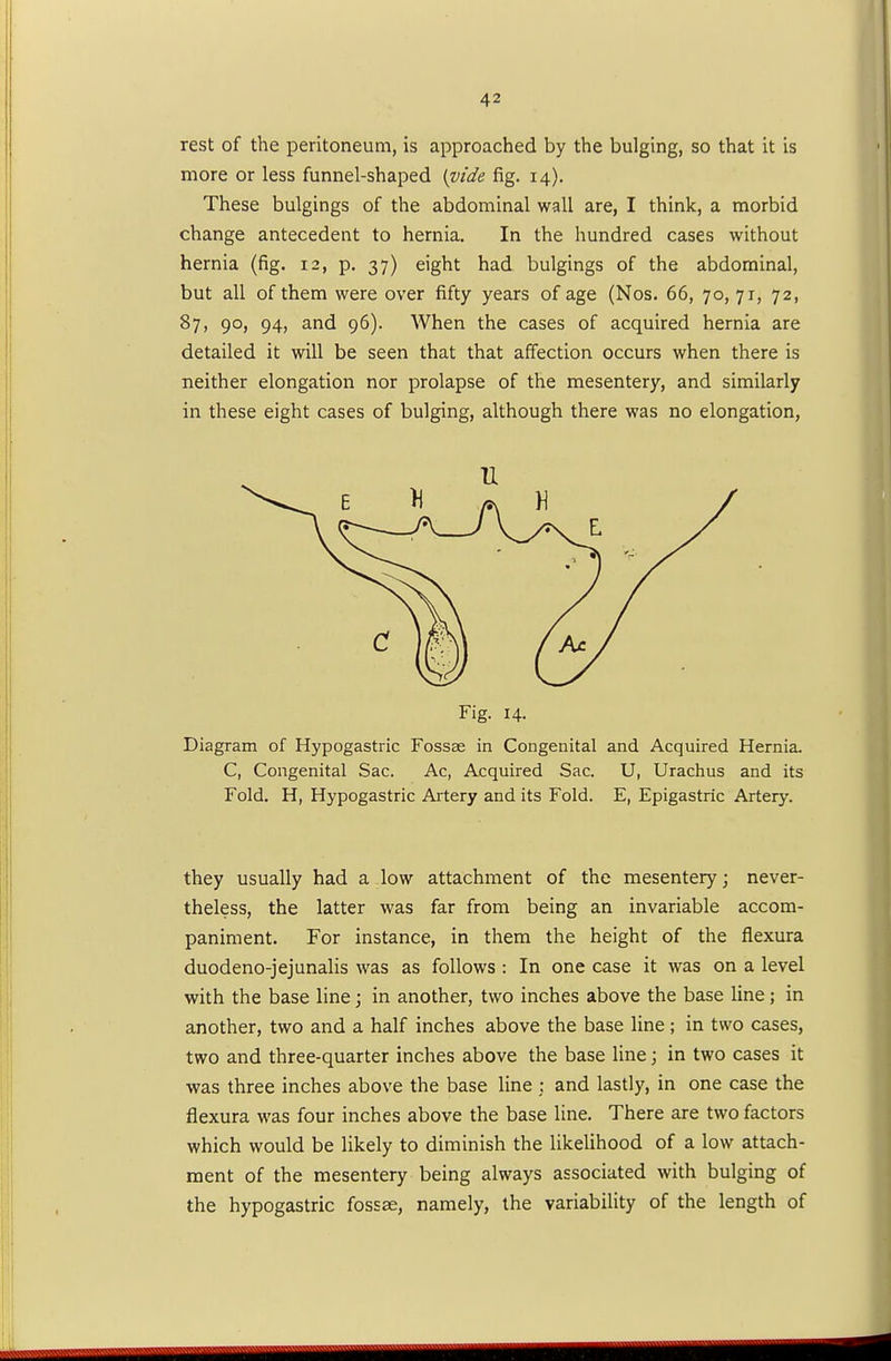 rest of the peritoneum, is approached by the bulging, so that it is more or less funnel-shaped {vide fig. 14). These bulgings of the abdominal wall are, I think, a morbid change antecedent to hernia. In the hundred cases without hernia (fig. 12, p. 37) eight had bulgings of the abdominal, but all of them were over fifty years of age (Nos. 66, 70, 71, 72, 87, 90, 94, and 96). When the cases of acquired hernia are detailed it will be seen that that affection occurs when there is neither elongation nor prolapse of the mesentery, and similarly in these eight cases of bulging, although there was no elongation, Fig. 14. Diagram of Hypogastric Fossae in Congenital and Acquired Hernia. C, Congenital Sac. Ac, Acquired Sac. U, Urachus and its Fold. H, Hypogastric Artery and its Fold. E, Epigastric Artery. they usually had a low attachment of the mesentery; never- theless, the latter was far from being an invariable accom- paniment. For instance, in them the height of the flexura duodeno-jejunalis was as follows : In one case it was on a level with the base line; in another, two inches above the base line; in another, two and a half inches above the base line ; in two cases, two and three-quarter inches above the base line; in two cases it was three inches above the base line : and lastly, in one case the flexura was four inches above the base line. There are two factors which would be likely to diminish the likelihood of a low attach- ment of the mesentery being always associated with bulging of the hypogastric fossae, namely, the variability of the length of