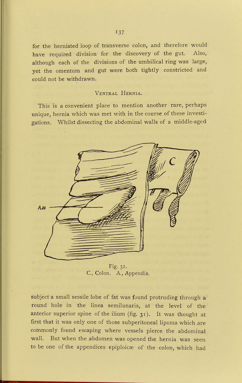 for the herniated loop of transverse colon, and therefore would have required division for the discovery of the gut. Also, although each of the divisions of the umbilical ring was large, yet the omentum and gut were both tightly constricted and could not be withdrawn. Ventral Hernia. This is a convenient place to mention another rare, perhaps unique, hernia which was met with in the course of these investi- gations. Whilst dissecting the abdominal walls of a middle-aged Fig- 3i- C, Colon. A., Appendix. subject a small sessile lobe of fat was found protruding through a round hole in the linea semilunaris, at the level of the anterior superior spine of the ilium (fig. 31). It was thought at first that it was only one of those subperitoneal lipoma which are commonly found escaping where vessels pierce the abdominal wall. But when the abdomen was opened the hernia was seen to be one of the appendices epiploicae of the colon, which had