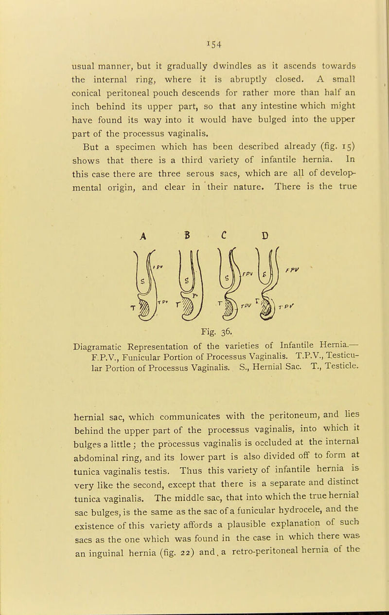 iS4 usual manner, but it gradually dwindles as it ascends towards the internal ring, where it is abruptly closed. A small conical peritoneal pouch descends for rather more than half an inch behind its upper part, so that any intestine which might have found its way into it would have bulged into the upper part of the processus vaginalis. But a specimen which has been described already (fig. 15) shows that there is a third variety of infantile hernia. In this case there are three serous sacs, which are all of develop- mental origin, and clear in their nature. There is the true A B C D Fig. 36. Diagramatic Representation of the varieties of Infantile Hernia.— F.P.V., Funicular Portion of Processus Vaginalis. T.P.V., Testicu- lar Portion of Processus Vaginalis. S., Hernial Sac. T., Testicle. hernial sac, which communicates with the peritoneum, and lies behind the upper part of the processus vaginalis, into which it bulges a little ; the processus vaginalis is occluded at the internal abdominal ring, and its lower part is also divided off to form at tunica vaginalis testis. Thus this variety of infantile hernia is very like the second, except that there is a separate and distinct tunica vaginalis. The middle sac, that into which the true hernial sac bulges, is the same as the sac of a funicular hydrocele, and the existence of this variety affords a plausible explanation of such sacs as the one which was found in the case in which there was an inguinal hernia (fig. 22) and. a retro-peritoneal hernia of the