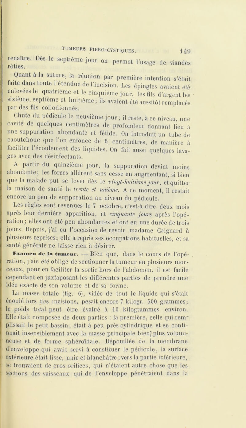 renaUre. Dès le septième jour on permet Dusage de viandes Quant à la suture, la réunion par première intention s’était faite dans toute retendue de l’incision. Les épingles avaient été enlevées le quatrième et le cinquième jour, les fils d’argent les sixième, septième et huitième; ils avaient été aussitôt remplacés par des fils collodionnés. Chute du pédicule le neuvième jour ; il reste, à ce niveau, une cavité de quelques centimètres de profondeur donnant lieu à une suppuration abondante et fétide. On introduit un tube de caoutchouc que Ion enfonce de 6 centimètres, de manière à faciliter l’écoulement des liquides. On fait aussi quelques lava- ges avec des désinfectants A partir du quinzième jour, la suppuration devint moins abondante; les forces allèrent sans cesse en augmentant, si bien que la malade put se lever dès le vingt-hvitïeme jour, et quitter la maison de santé le trente et unième. A ce moment, il restait encore un peu de suppuration au niveau du pédicule. Les règles sont revenues le 7 octobre, c’est-à-dire deux mois après leur dernière apparition, et cinquante jours après l’opé- ration; elles ont été peu abondantes et ont eu une durée de trois jours. Depuis, j’ai eu l’occasion de revoir madame Caignard à plusieurs reprises; elle a repris ses occupations habituelles, et sa santé générale ne laisse rien à désirer. Examen de la tumeur. — 13igii que, dans le cours de l’opé- ration, j'aie été obligé de sectionner la tumeur en plusieurs mor- ceaux, pour en faciliter la sortie hors de l’abdomen, il est facile cependant en juxtaposant les différentes parties de prendre une idée exacte de son volume et de sa forme. La masse totale (fig. 6), vidée de tout le liquide qui s’était écoulé lors des incisions, pesait encore 7 kilogr. 500 grammes; le poids total peut être évalué à 10 kilogrammes environ. Elle était composée de deux parties : la première, celle qui rem- plissait le petit bassin, était à peu près cylindrique et se conti- nuait insensiblement avec la masse principale bien] plus volumi- neuse et de forme sphéroïdale. Dépouillée de la membrane d’enveloppe qui avait servi à constituer le pédicule, la surface extérieure était lisse, unie et blanchâtre ; vers la partie inférieure, se trouvaient de gros orifices, qui n’étaient autre chose que les sections des vaisseaux qui de l’enveloppe pénétraient dans la