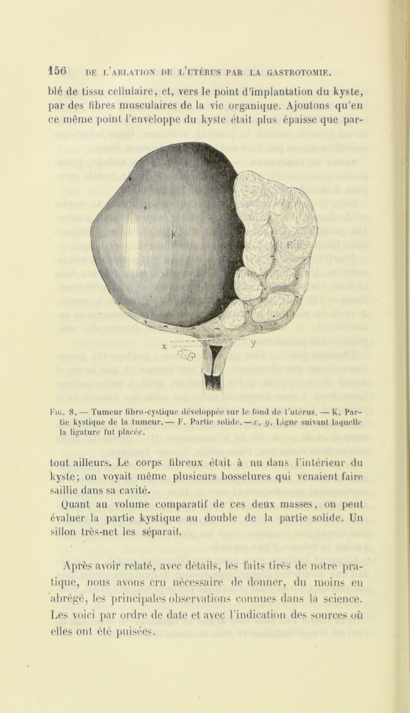 blé de tissu cellulaire, et, vers le point d’implantation du kyste, par des fibres musculaires de la vie organique. Ajoutons qu’en ce même point l’enveloppe du kyste était plus épaisse que par- Fig. 8. — Tumeur fibro-cystique développée sur le fond de l’utérus. — K. Par- tie kystique de la tumeur.— F. Partie solide.—x, y. Ligne suivant laquelle la ligature fut placée. tout ailleurs. Le corps fibreux était à nu dans l’intérieur du kyste; on voyait même plusieurs bosselures qui venaient faire saillie dans sa cavité. Quant au volume comparatif de ces deux masses, on peut évaluer la partie kystique au double de la partie solide. Un sillon très-net les séparait. Après avoir relaté, avec détails, les faits tirés do notre pra- tique, nous avons cru nécessaire de donner, du moins en abrégé, les principales observations connues dans la science. Les voici par ordre de date et avec l’indication des sources où elles ont été puisées.