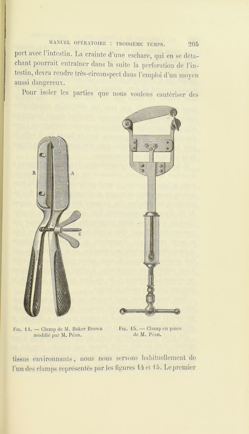 poit a\ec I intestin. La crainte d’une eschare, qui en se déta- chant ponnait entraîner dans la suite la perforation de l’in- testin, dévia îendre très-circonspect dans l’emploi d’un moyen aussi dangereux. Pour isoler les parties que nous voulons cautériser des Fig. 1 â. — Glamp de M. Baker Brown Fig. 15. — Clamp en pince modifié par M. Péan. de M. Péan. tissus environnants, nous nous servons habituellement de l’un des clamps représentés par les figures l/i et 15. Le premier