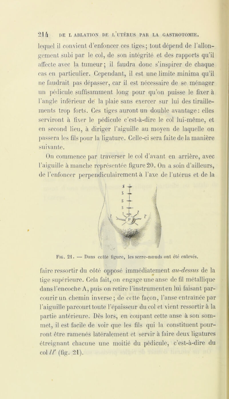 lequel il convient d’enfoncer ces tiges; tout dépend de rallon- gement subi par le col, de son intégrité et des rapports qu’il affecte avec la tumeur; il faudra donc s’inspirer de chaque cas en particulier. Cependant, il est une limite minima qu’il ne faudrait pas dépasser, car il est nécessaire de se ménager un pédicule suffisamment long pour qu’on puisse le fixer à l’angle inférieur de la plaie sans exercer sur lui des tiraille- ments trop forts. Ces tiges auront un double avantage : elles serviront à fixer le pédicule c’est-à-dire le col lui-même, et en second lieu, à diriger l’aiguille au moyen de laquelle on passera les fils pour la ligature. Celle-ci sera faite de la manière suivante. On commence par traverser le col d’avant en arrière, avec l’aiguille à manche représentée figure 20. On a soin d’ailleurs, de l’enlbncer perpendiculairement à l’axe de l’utérus et de la Fig. 21. — Dans celte figure, les serre-nœuds ont été enlevés. faire ressortir du côté opposé immédiatement au-dessus de la tige supérieure. Cela fait, on engage une anse de fil métallique dans l’encoche A, puis on retire l’instrumenten lui faisant par- courir un chemin inverse; de cette façon, l’anse entraînée par l’aiguille parcourt toute l’épaisseur du col et vient ressortir à la partie antérieure. Dès lors, en coupant cette anse à son som- met, il est facile de voir que les fils qui la constituent pour- ront être ramenés latéralement et servir à faire deux ligatures étreignant chacune une moitié du pédicule, c’est-à-dire du col U' (fig. 21).