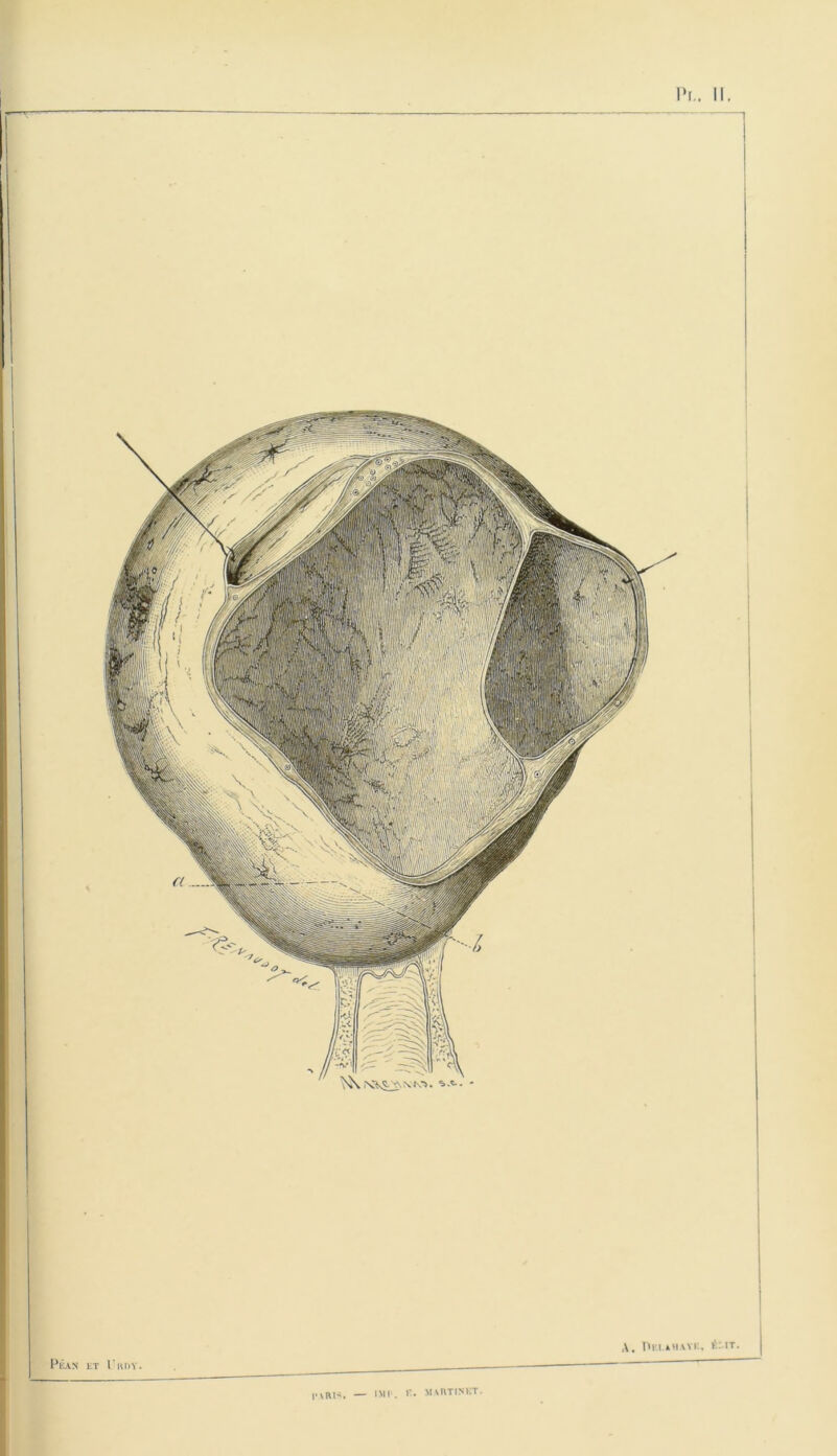 Pi.. Il l'VRH. — IMP. R. MARTINET.