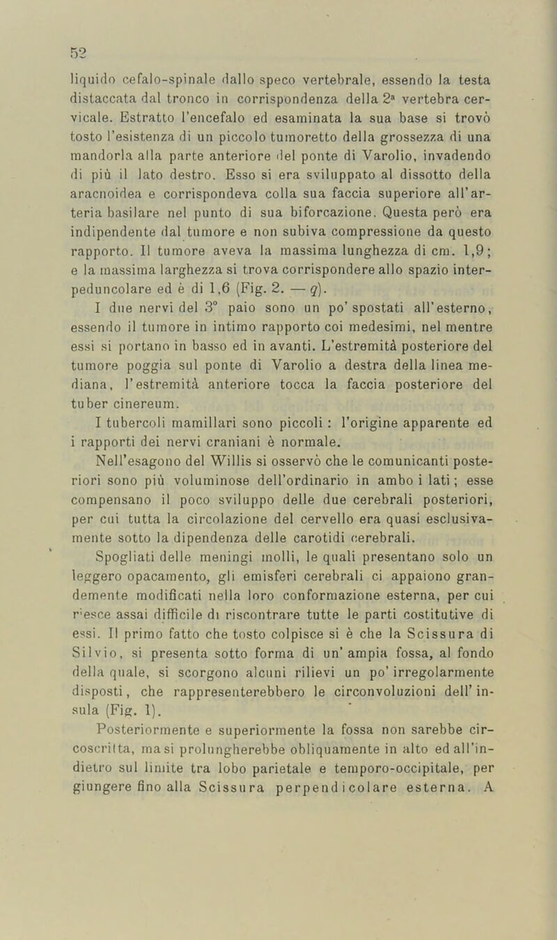 liquido cefalo-spinale dallo speco vertebrale, essendo la testa distaccata dal tronco in corrispondenza della 2® vertebra cer- vicale. Estratto I’encefalo ed esaminata la sua base si trovo tosto I’esistenza di un piccolo tuinoretto della grossezza di una mandorla alia parte anteriore del ponte di Varolio, invadendo di piii il lato destro. Esso si era sviliippato al dissotto della aracnoidea e corrispondeva colla sua faccia superiore all’ar- teria basilare nel punto di sua biforcazione. Questa pero era indipendente dal tumore e non subiva compressione da questo rapporto. 11 tumore aveva la raassima lunghezza di cm. 1,9; e la massima larghezza si trova corrispondere alio spazio inter- peduncolare ed e di 1,6 (Fig. 2. —^). 1 due nervi del 3“ paio sono un po’spostati all’esterno, essendo il tumore in intimo rapporto coi medesimi, nel mentre essi si portano in basso ed in avanti. L’estremitA posteriore del tumore poggia sul ponte di Varolio a destra della linea me- diana, I’estremiti anteriore tocca la faccia posteriore del tuber cinereum. 1 tubercoli mamillari sono piccoli: I’origine apparente ed i rapporti dei nervi craniani e normale. Nell’esagono del Willis si osservo che le comunicanti poste- riori sono piii voluminose dell’ordinario in ambo i lati; esse compensano il poco sviluppo delle due cerebrali posteriori, per cui tutta la circolazione del cervello era quasi esclusiva- mente sotto la dipendenza delle carotid! cerebrali. Spogliati delle meningi inolli, le quali presentano solo un leggero opacamento, gli emisferi cerebrali ci appaiono gran- demente modificati nella loro conformazione esterna, per cui resce assai difficile di riscontrare tutte le parti costitutive di essi. Il primo fatto che tosto colpisce si e che la Scissura di Silvio, si presenta sotto forma di un’ampia fossa, al fondo della quale, si scorgono alcuni rilievi un po’ irregolarmente disposti, che rappresenterebbero le circonvoluzioni dell’in- sula (Fig. 1). Posteriormente e superiormente la fossa non sarebbe cir- coscrilta, masi prolungherebbe obliquamente in alto edall’in- dietro sul limite tra lobo parietale e temporo-occipitale, per giungere fino alia Scissura perpend icolare esterna. A