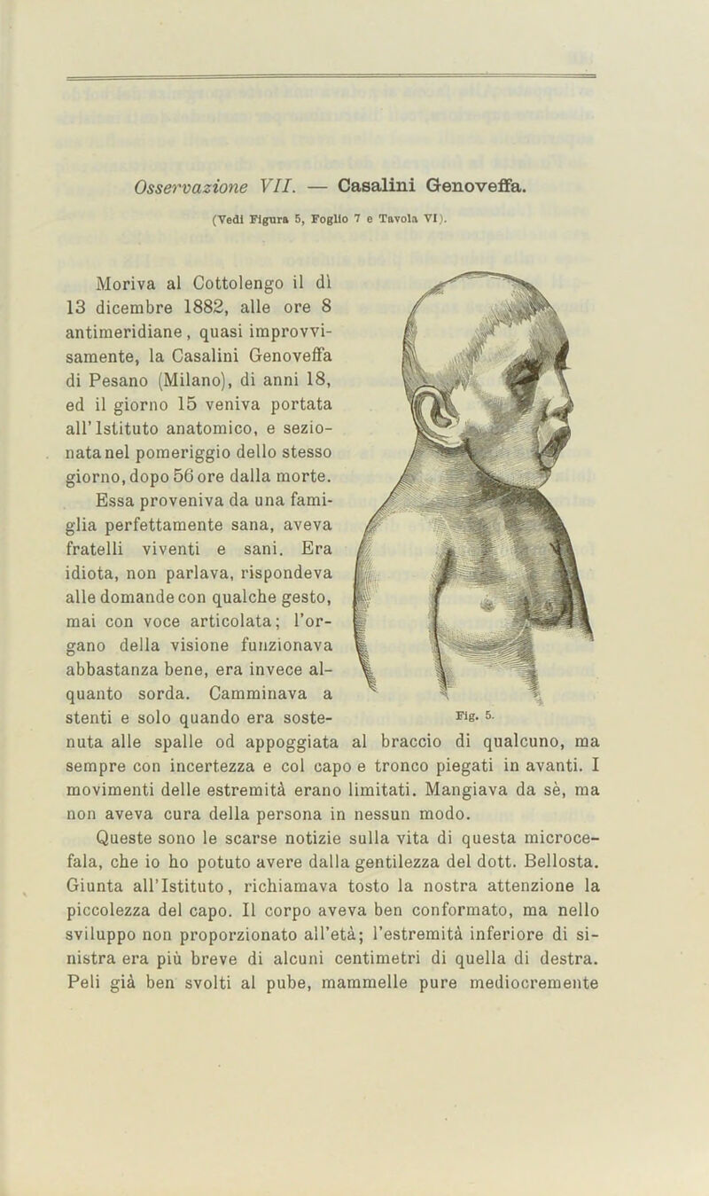 (Vedl ligura 5, Foglio 7 e Tavola VI ,i. Moriva al Cottolengo il di 13 dicembre 1882, alle ore 8 antimeridiane, quasi improvvi- samente, la Casalini Genoveffa di Pesano (Milano), di anni 18, ed il giorno 15 veniva portata airistituto anatomico, e sezio- natanel pomeriggio dello stesso giorno, dopo 56 ore dalla morte. Essa proveniva da una fami- glia perfettamente sana, aveva fratelli viventi e sani. Era idiota, non parlava, rispondeva alle domande con qualche gesto, mai con voce articolata; I’or- gano della visione funzionava abbastanza bene, era invece al- quanto sorda. Camminava a stenti e solo quando era soste- s- nuta alle spalle od appoggiata al braccio di qualcuno, ma sempre con incertezza e col capo e tronco piegati in avanti. I movimenti delle estremit^ erano limitati. Mangiava da se, raa non aveva cura della persona in nessun modo. Queste sono le scarse notizie sulla vita di questa microce- fala, che io ho potato avere dalla gentilezza del dott. Bellosta. Giunta all’Istituto, richiamava tosto la nostra attenzione la piccolezza del capo. Il corpo aveva ben conformato, ma nello sviluppo non proporzionato all’eta; I’estreraitd inferiore di si- nistra era piu breve di alcuni centimetri di quella di destra. Peli gi^i ben svolti al pube, mammelle pure mediocremente