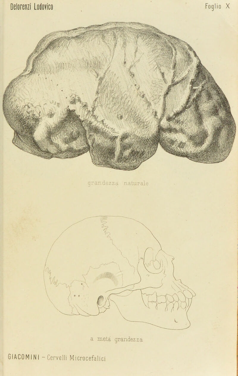 a meta grandezza . GIACOMINI -Cervelli Microcefalici Foglio X Delorenzi Lodovico