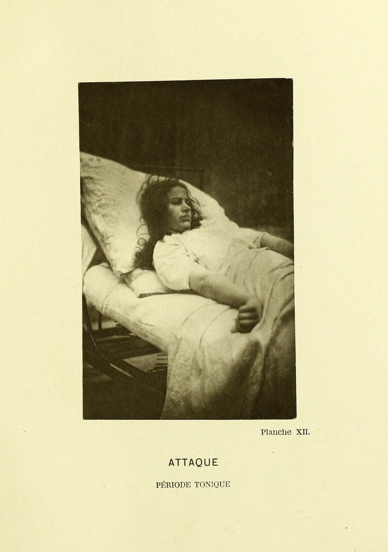 ATTAQUE