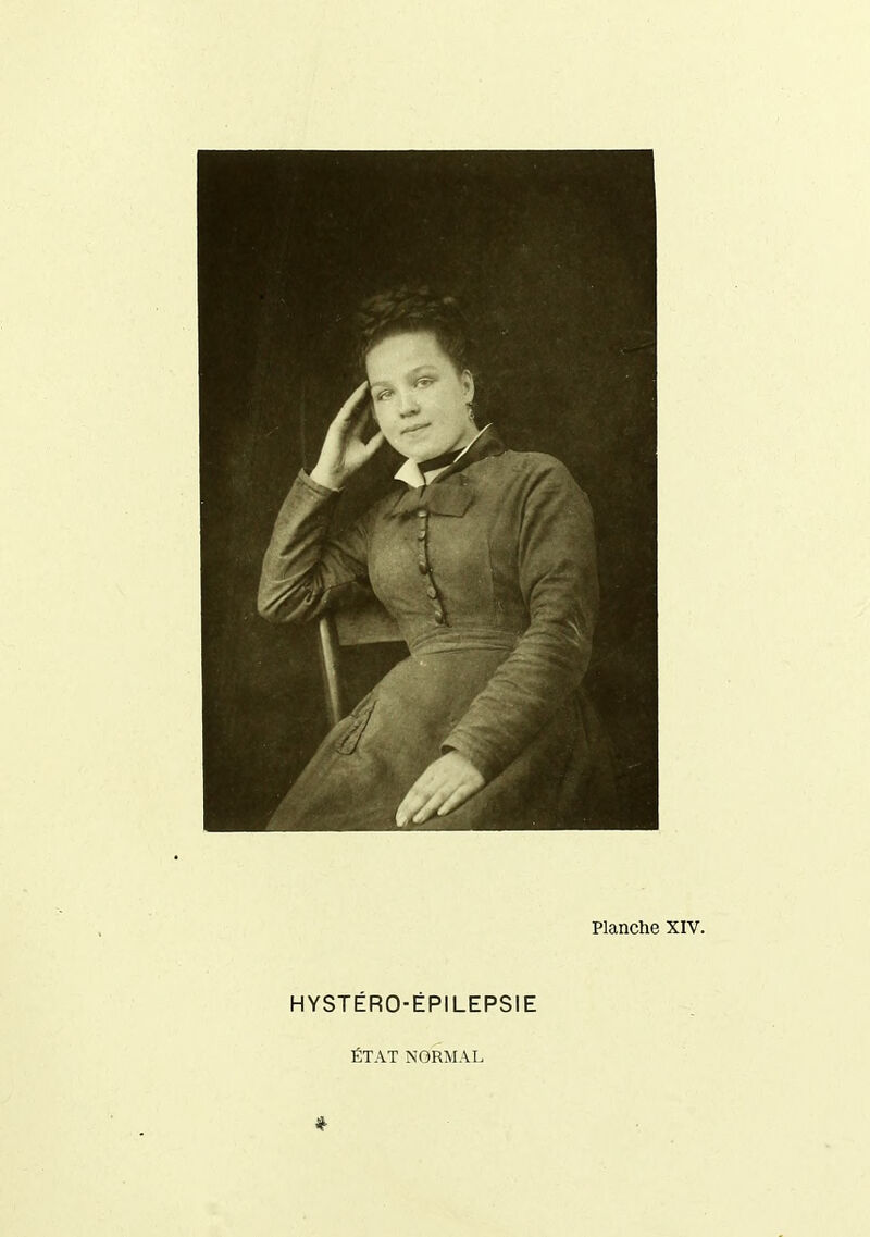 HYSTÉRO-ÉPILEPSIE